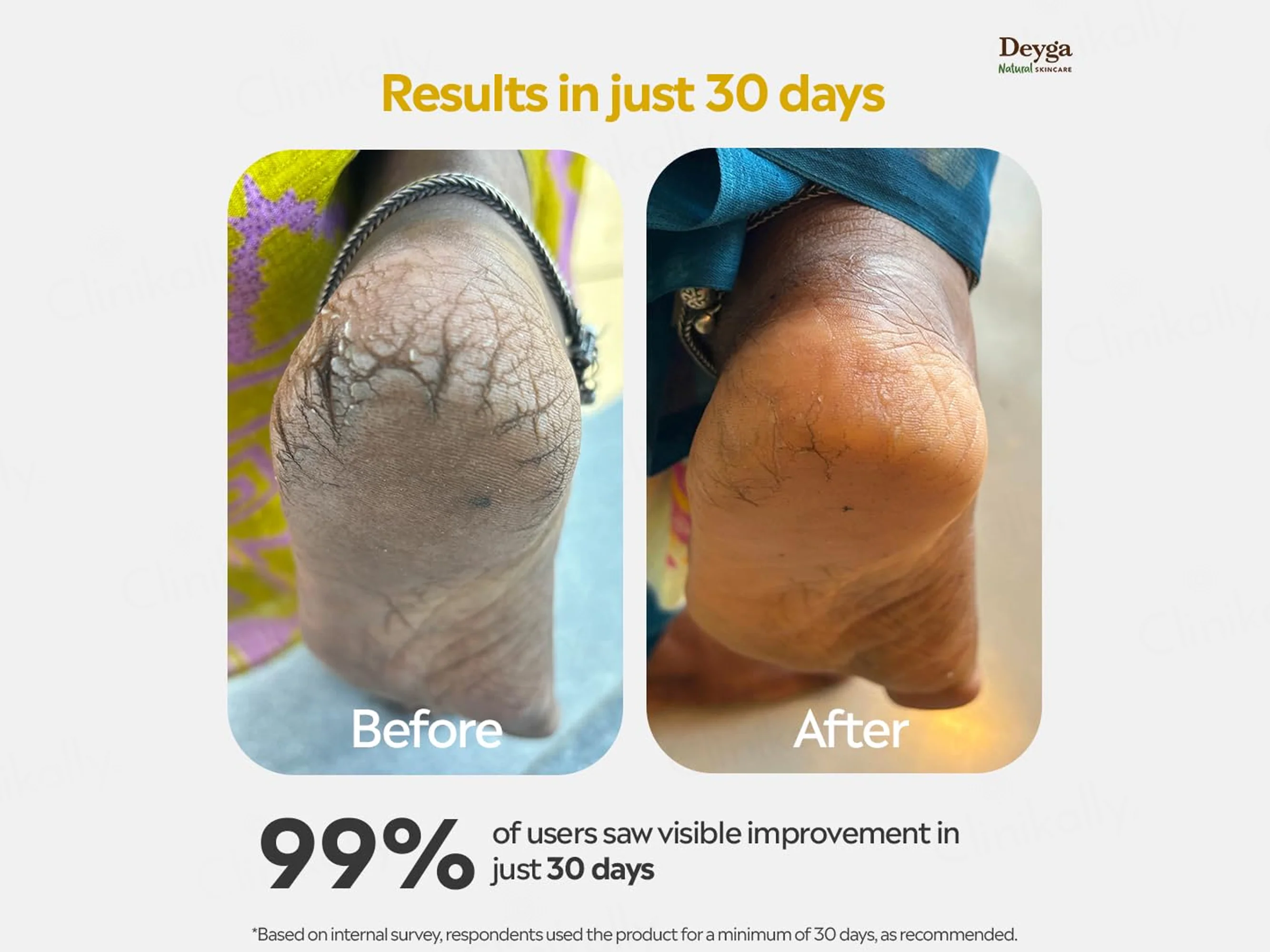 Deyga Foot Butter - Image 2