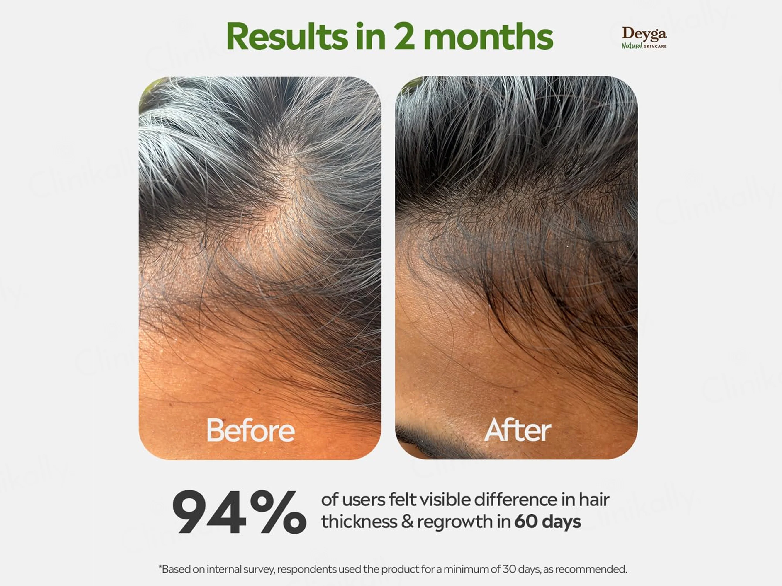 Deyga Hair Growth Oil - Image 7