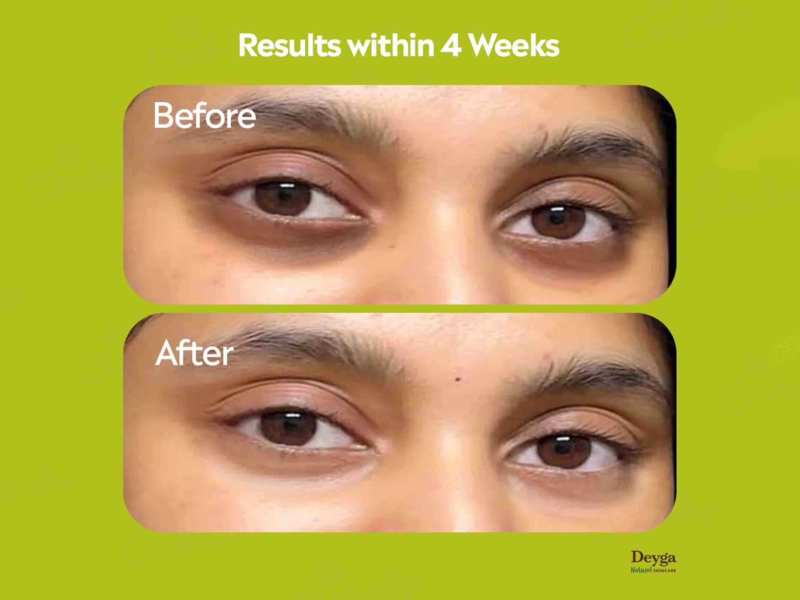 Deyga Under Eye Cream - Image 2