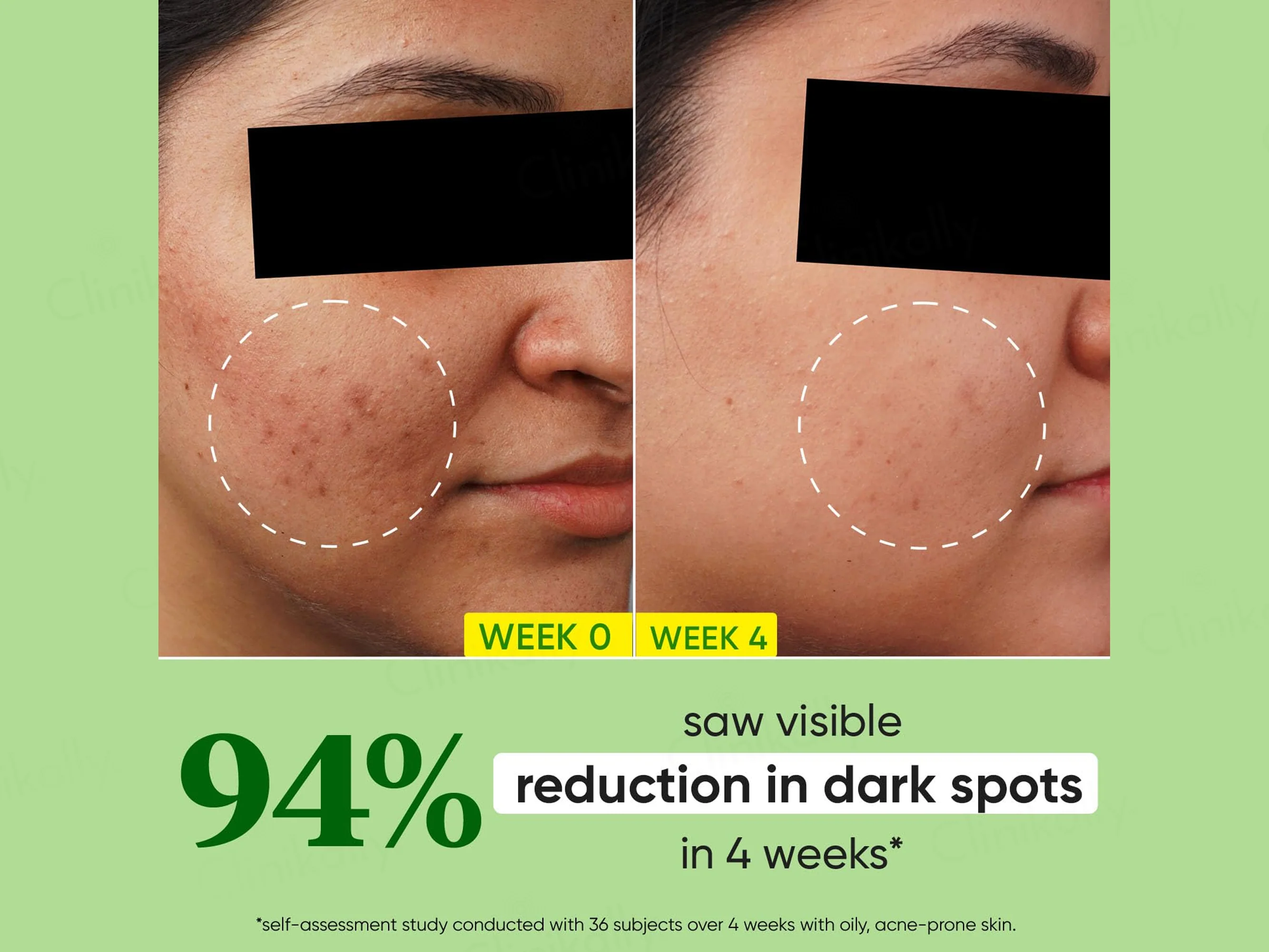 Dot & Key Cica + 10% Niacinamide Spot Reduction Face Serum - Image 6