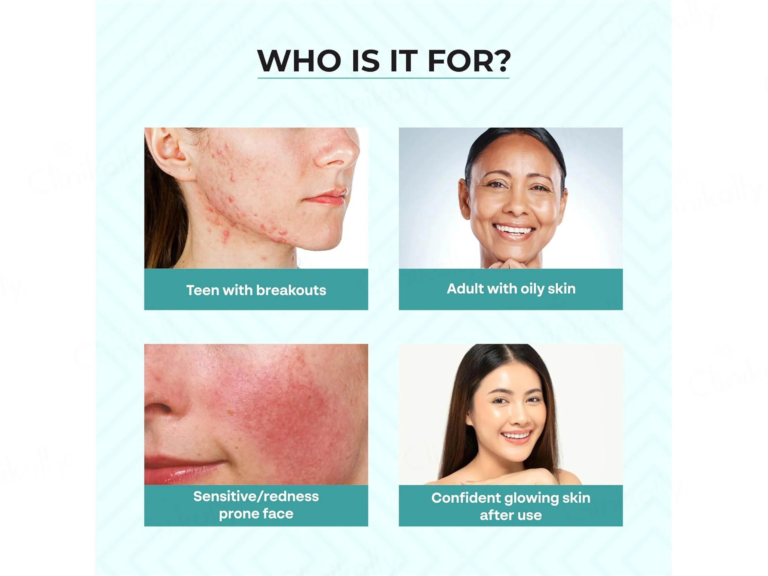 Dr. Sakhiya’s Acne & Pimple Care Kit - Image 4