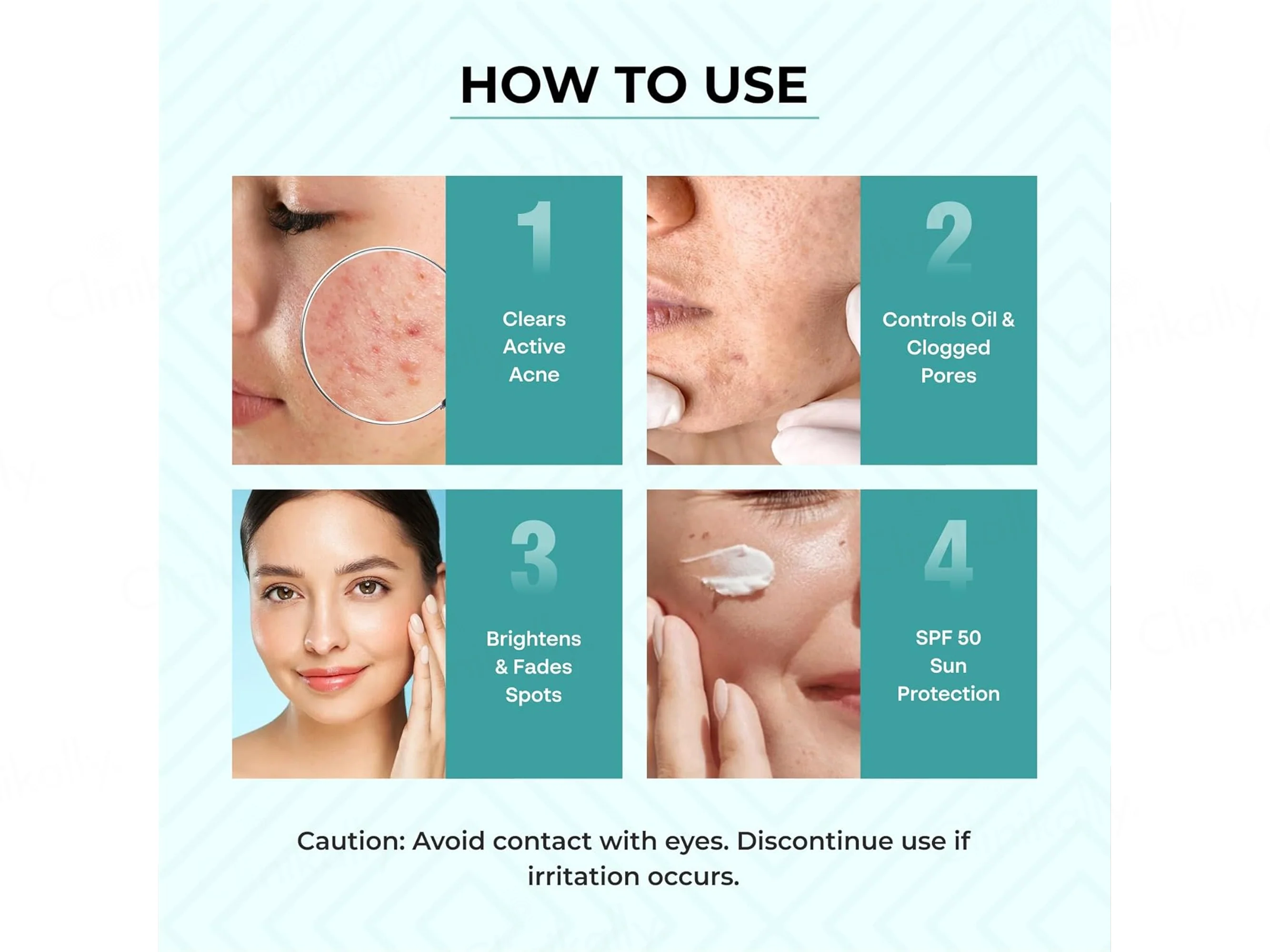 Dr. Sakhiya’s Acne & Pimple Care Kit - Image 7