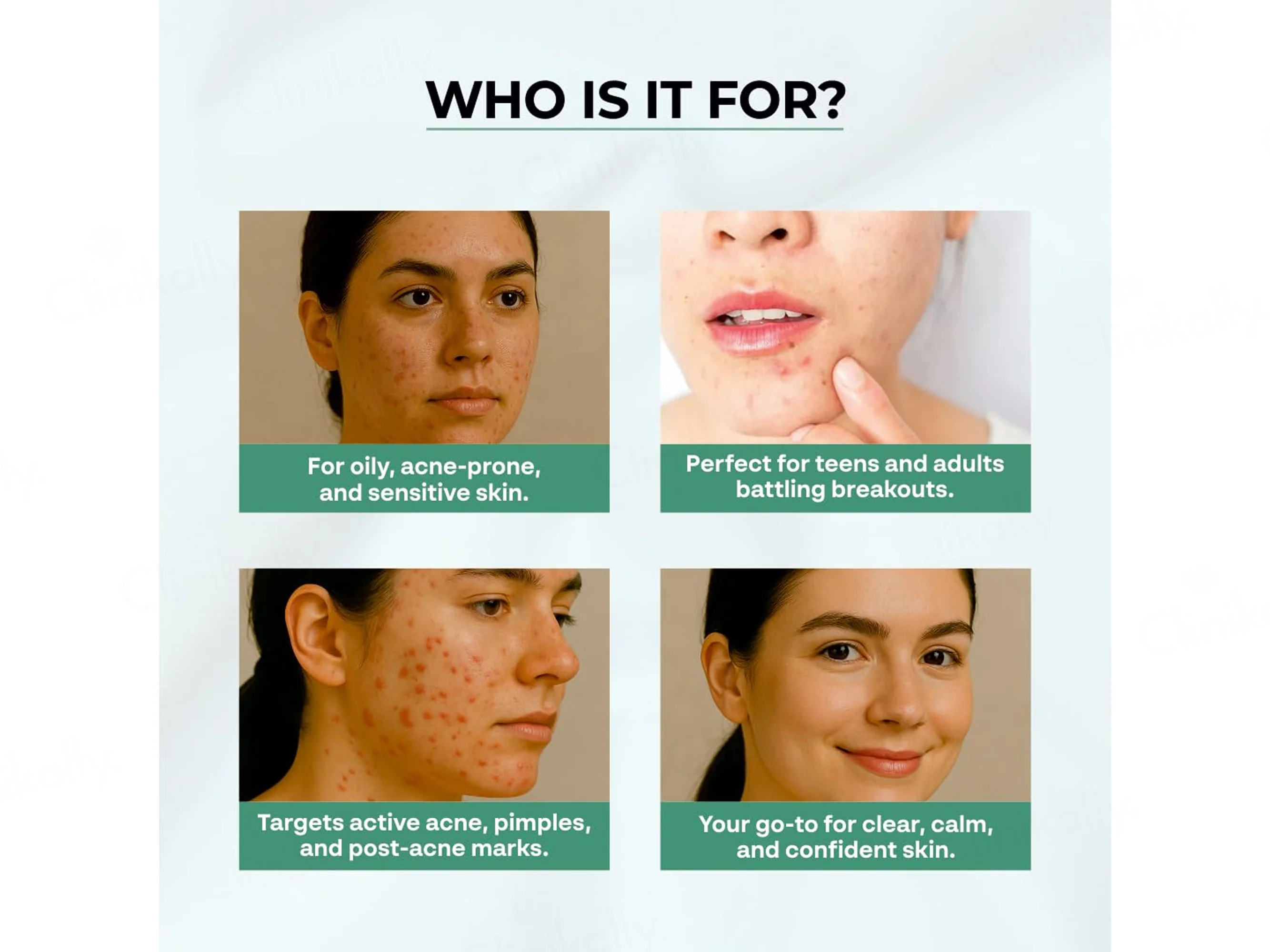 Dr. Sakhiya’s Acne & Pimple Moisturizer - Image 2