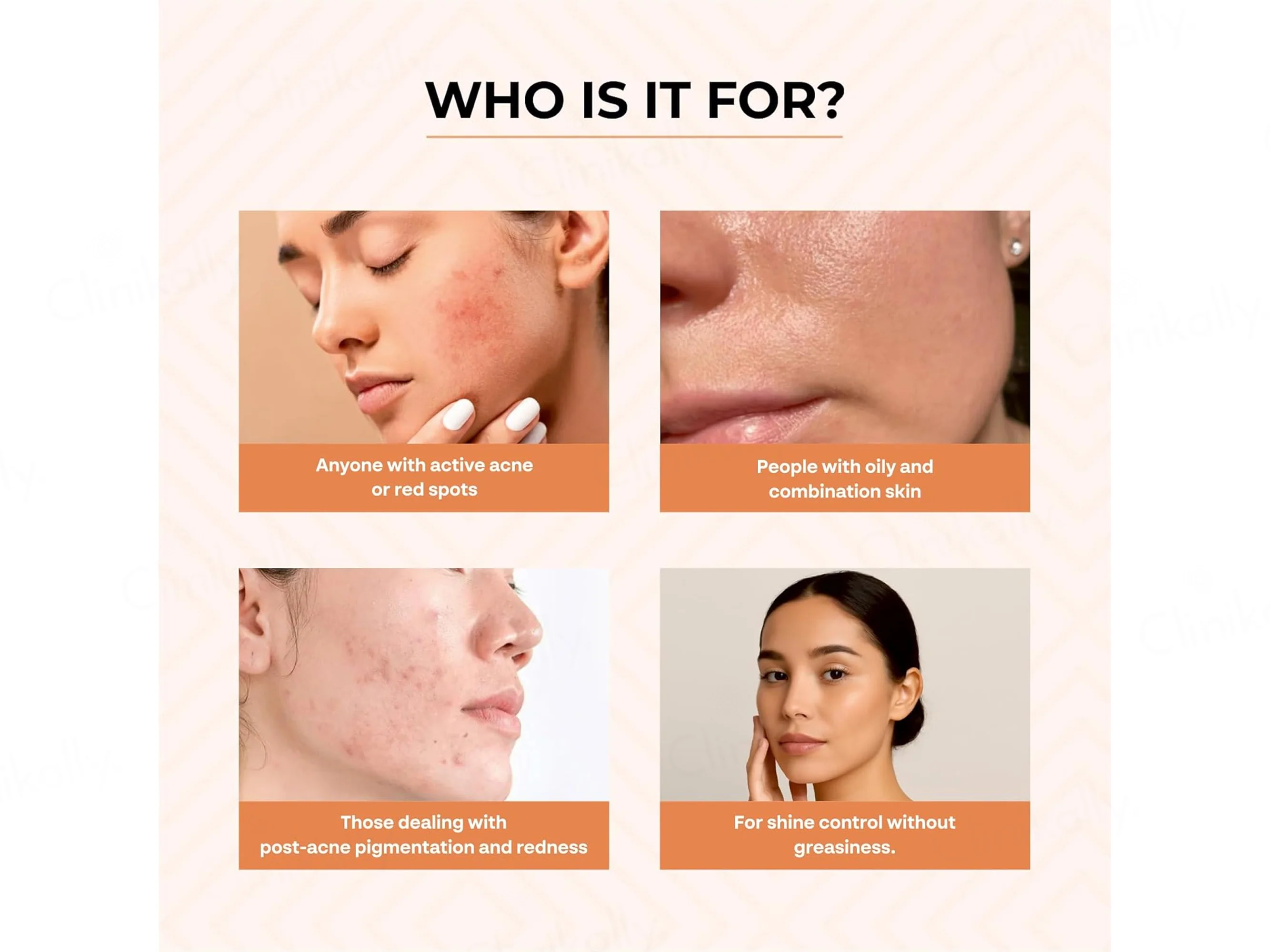 Dr. Sakhiya’s Acne & Pimple Morning Cream - Image 2