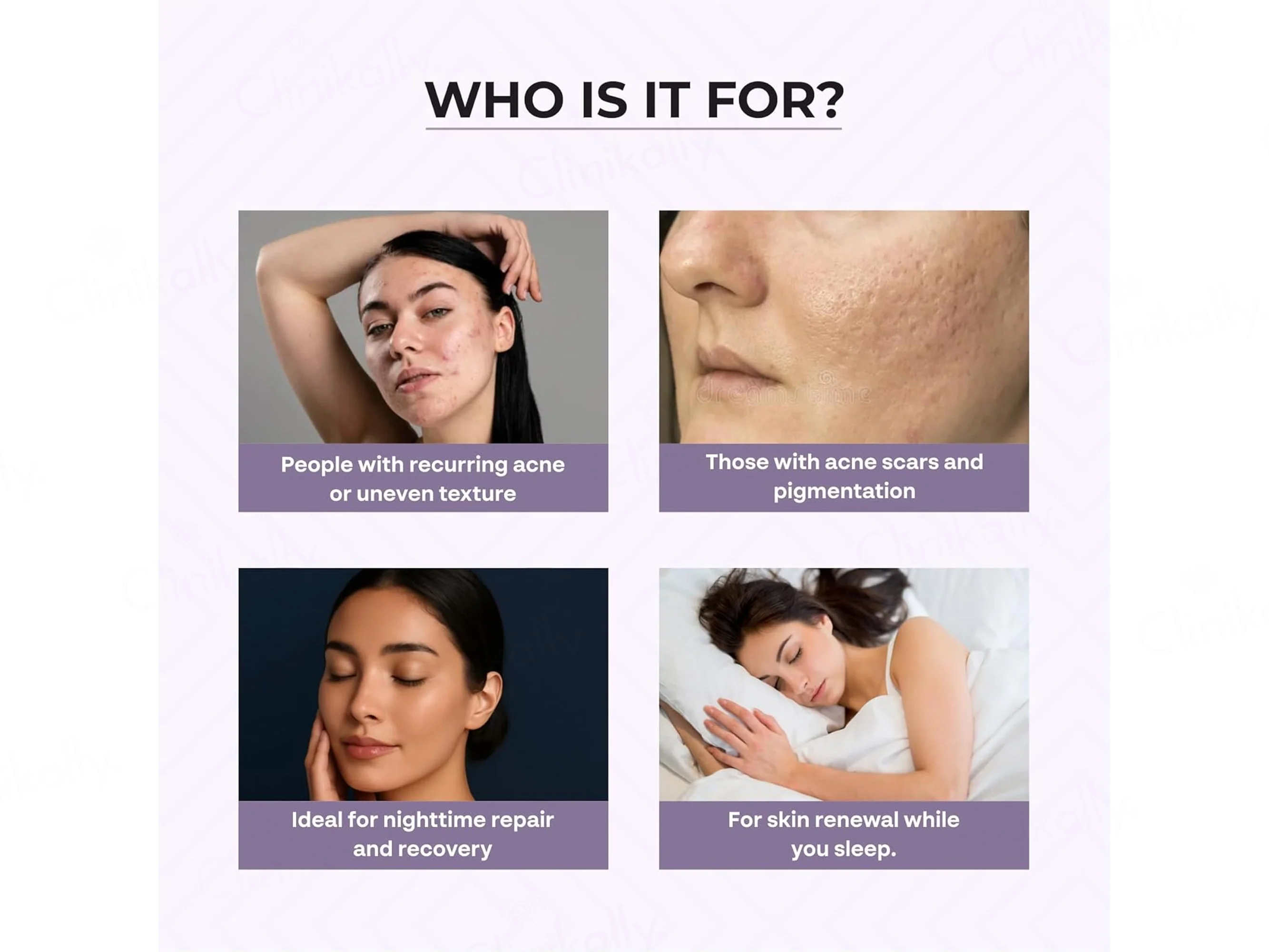 Dr. Sakhiya’s Acne & Pimple Night Cream - Image 4