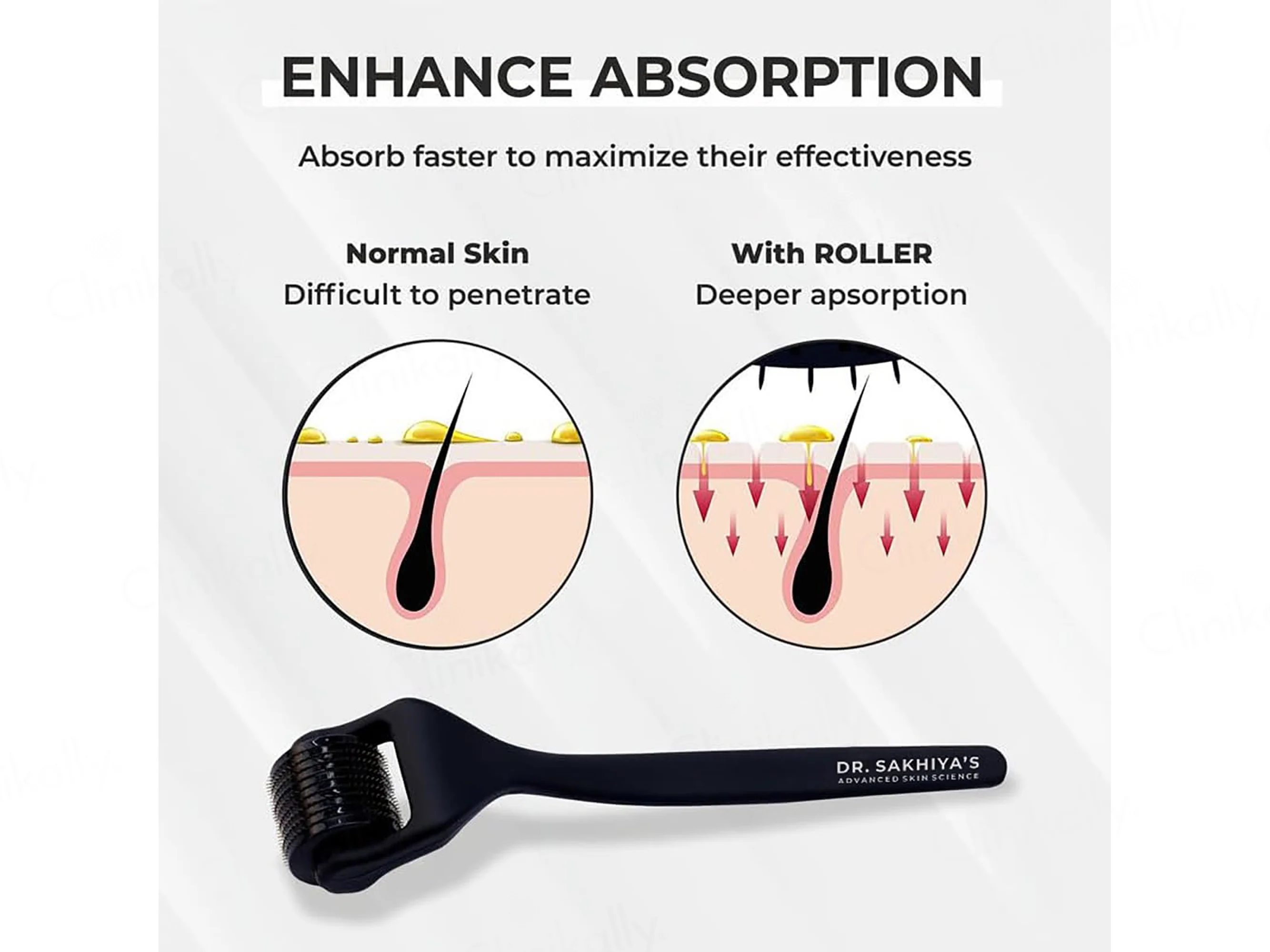 Dr. Sakhiya’s Advance Hair Activator Derma Roller - Image 6