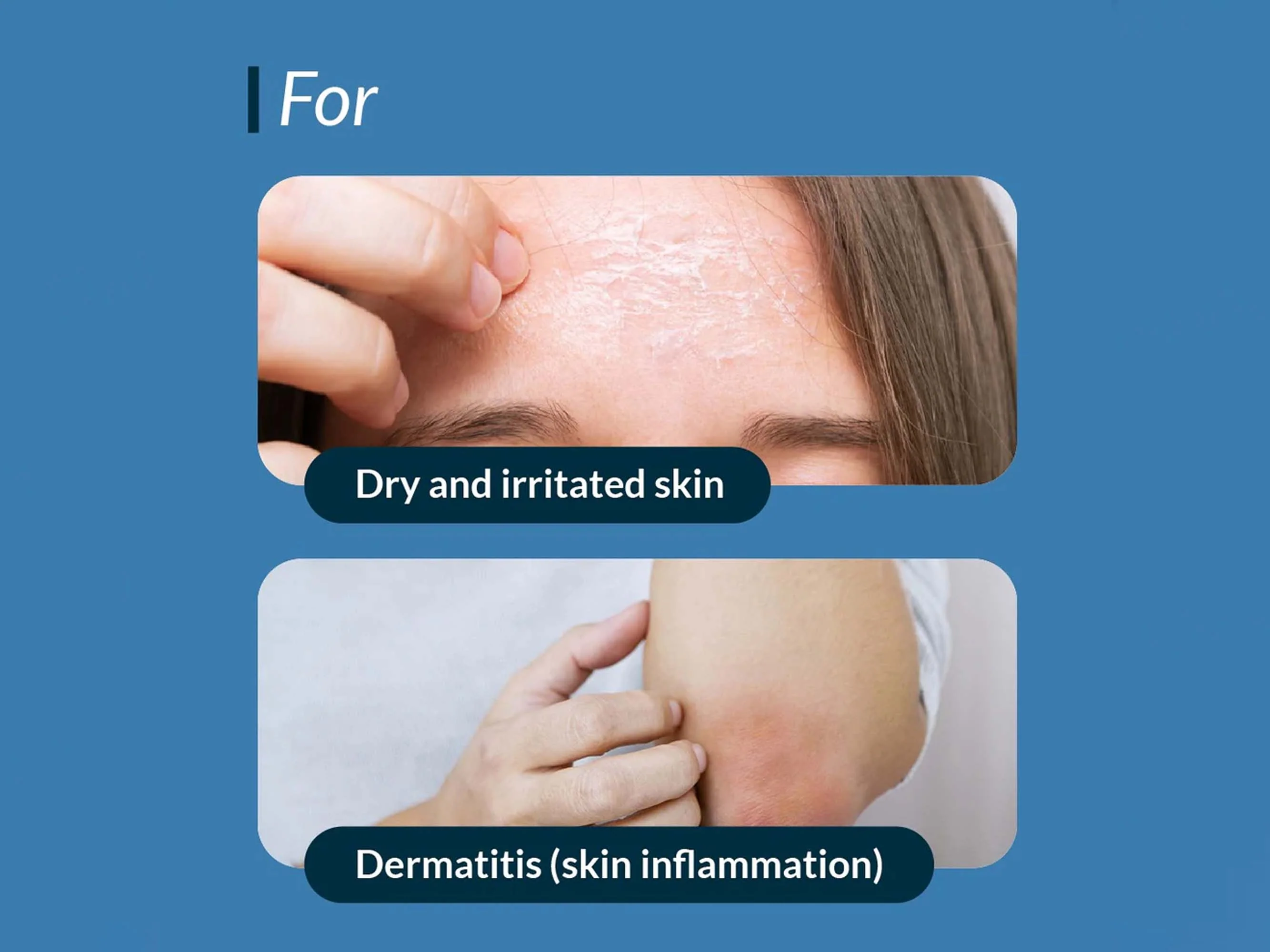 Duramoist Hydro Boost Moisturizer - Image 4