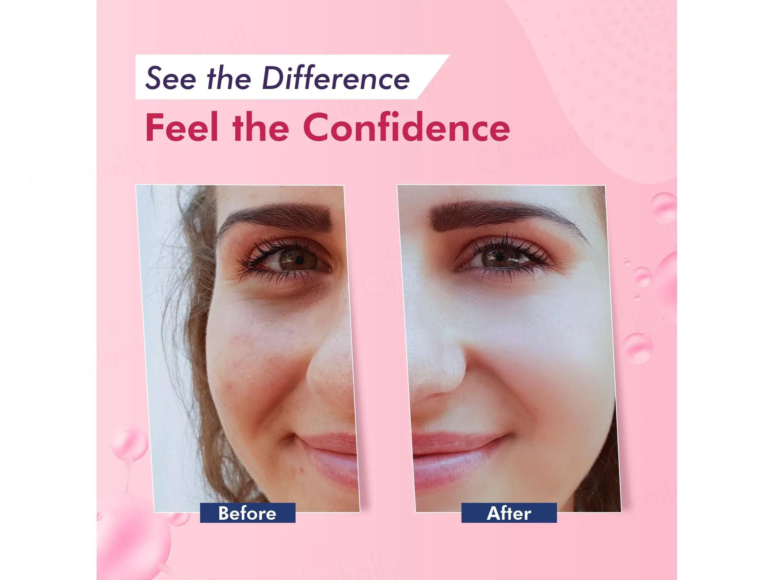 Enshiner Dark Spots Correcting Cream - Image 9