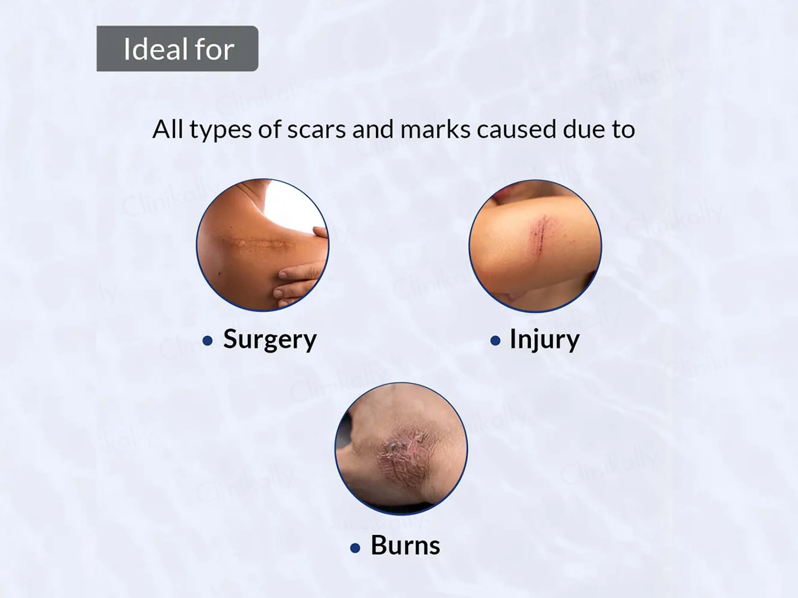 Fixderma Scar Gel - Image 4