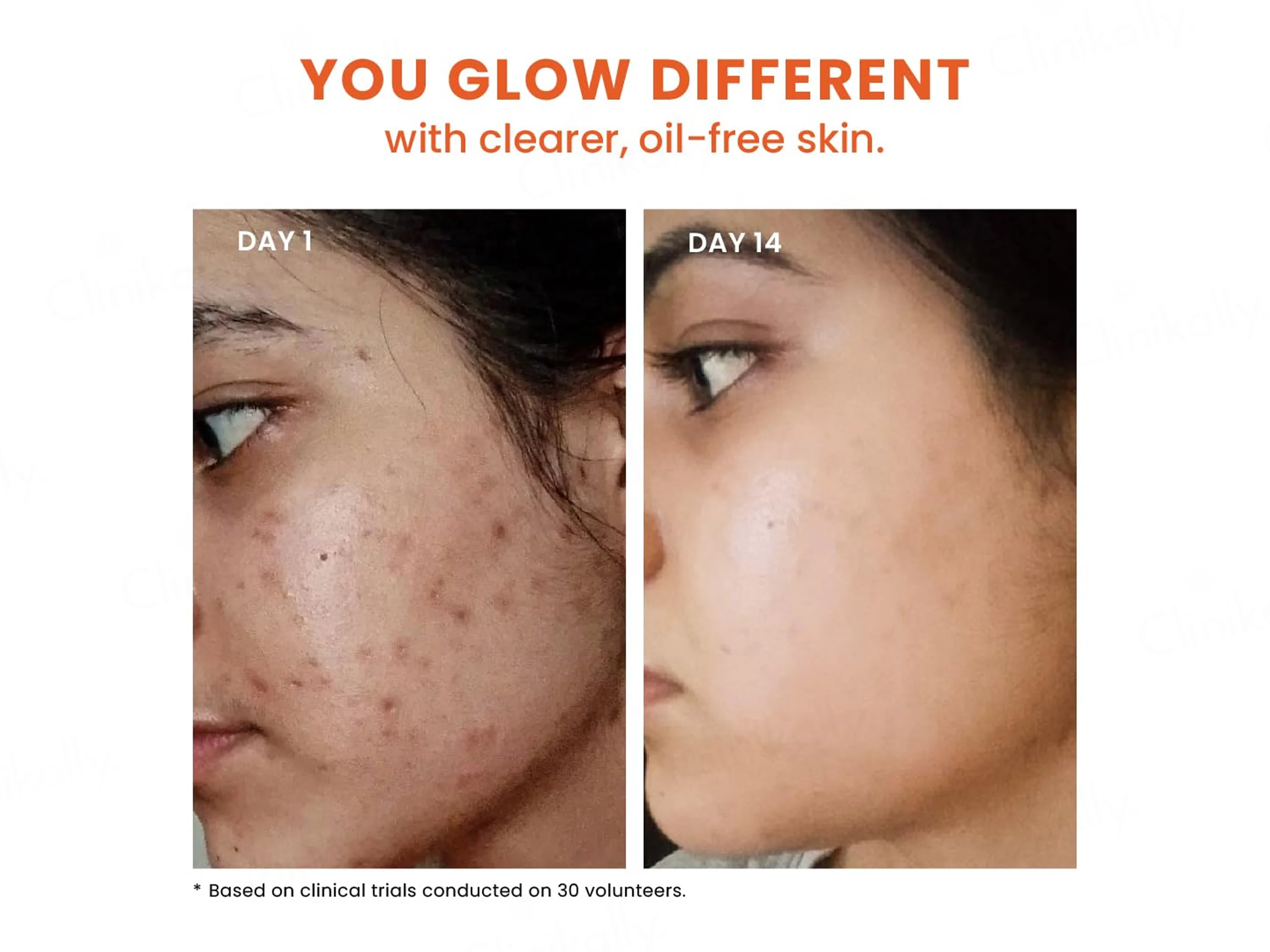 Foxtale 12% Niacinamide + Azelaic Acid Clarifying Serum - Image 6