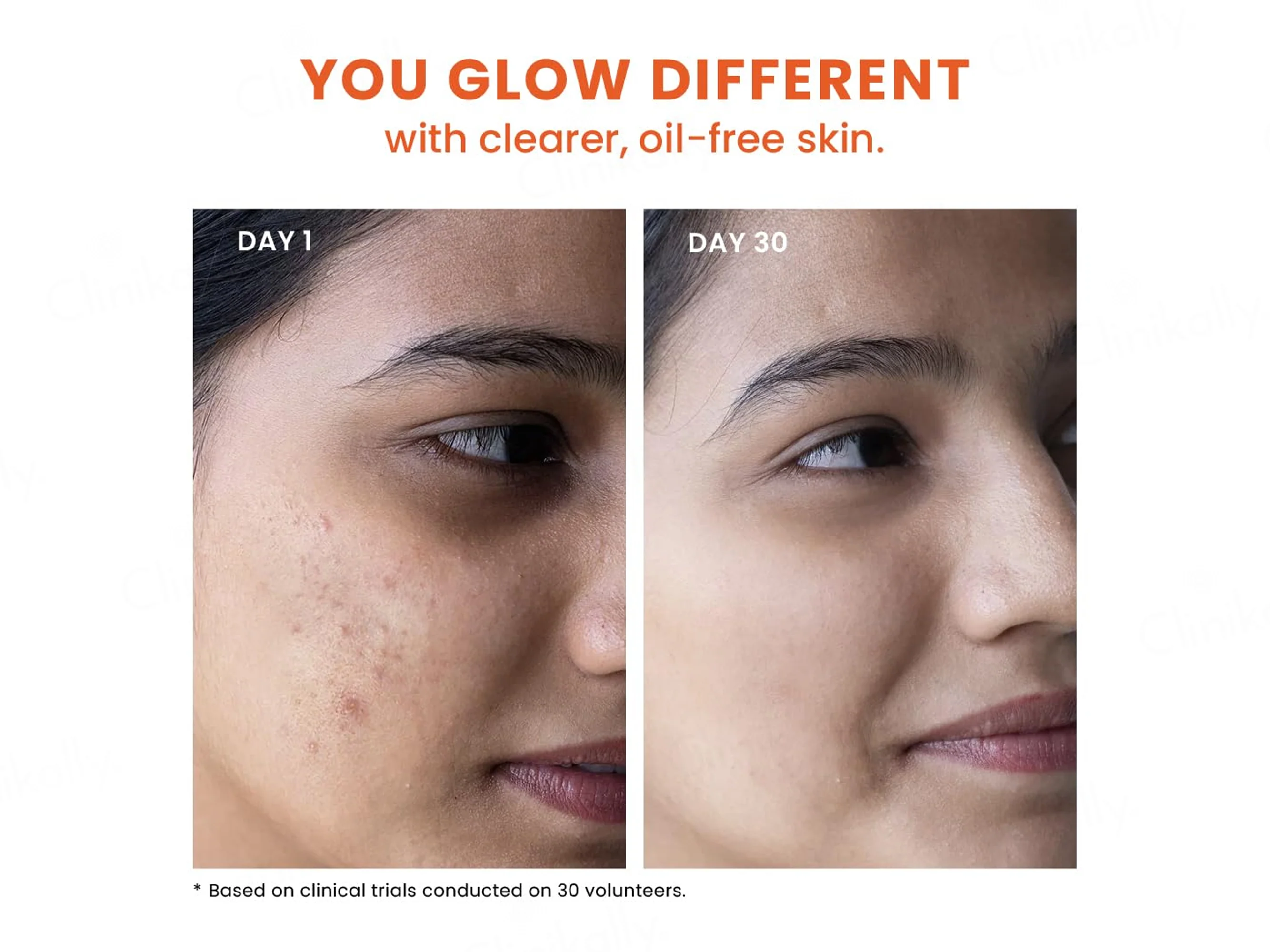 Foxtale Acne Control Cleanser - Image 6