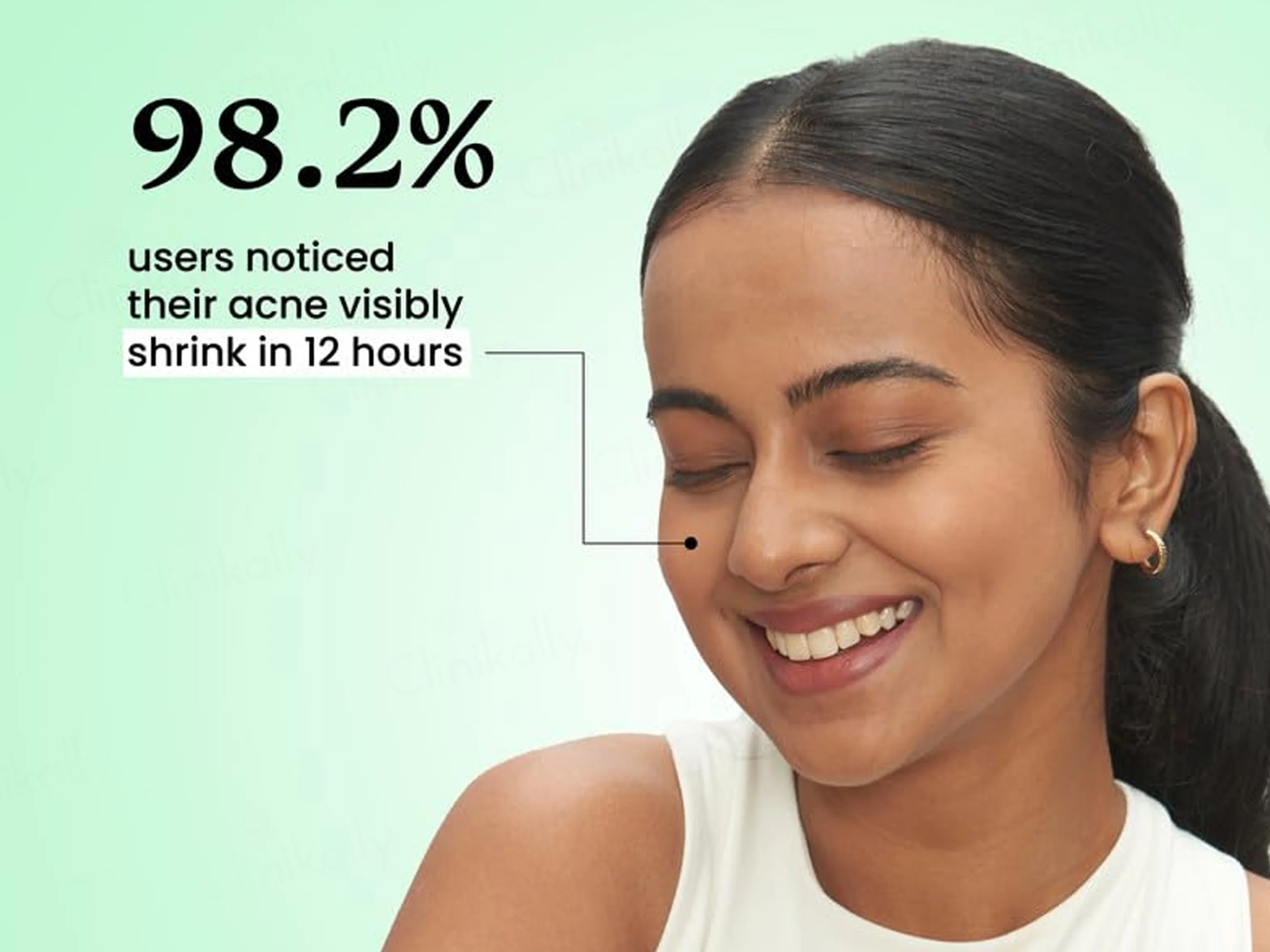 Foxtale Acne Spot Corrector Gel - Image 3