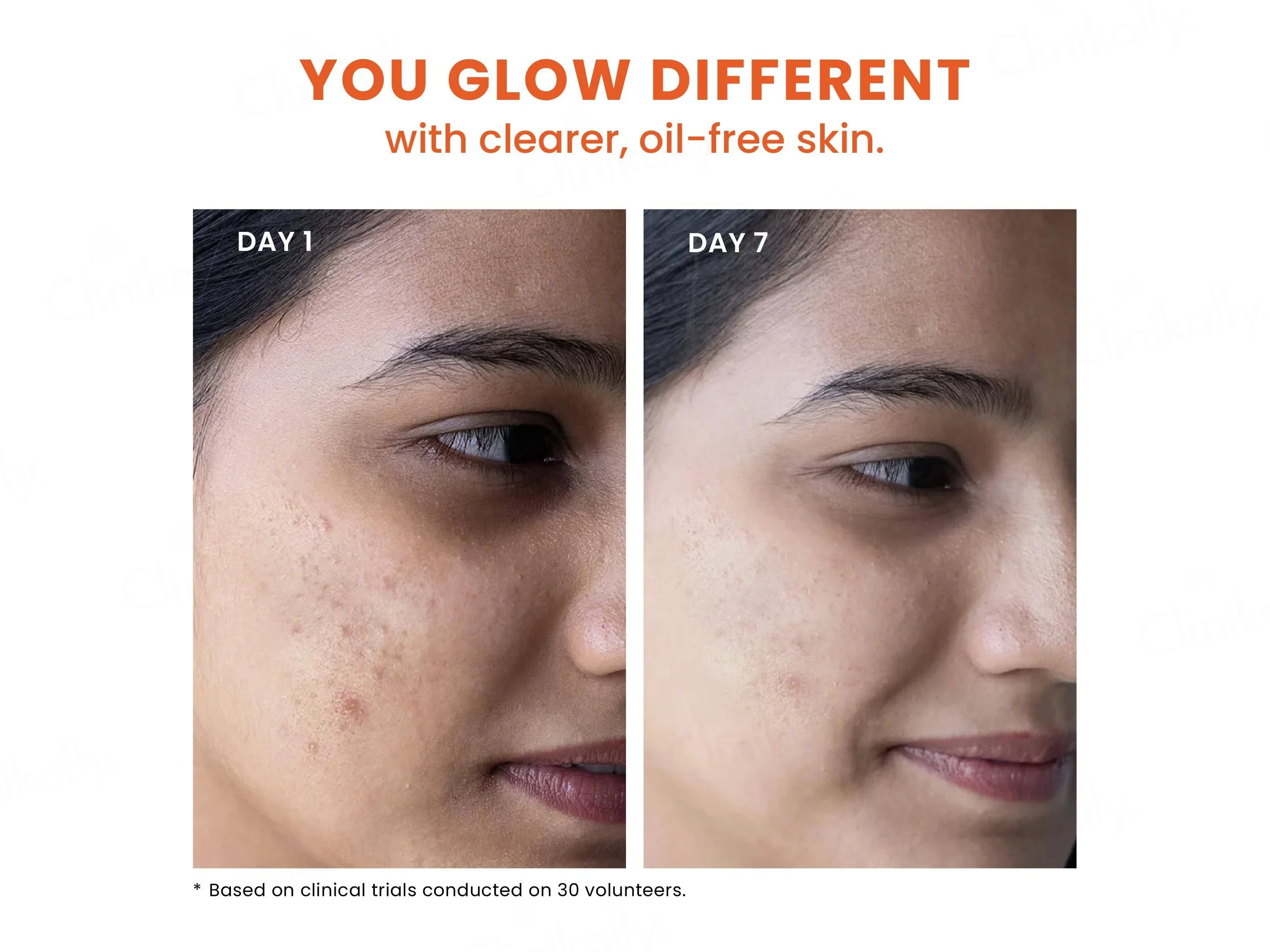 Foxtale Oil & Acne Control Face Wash - Image 6