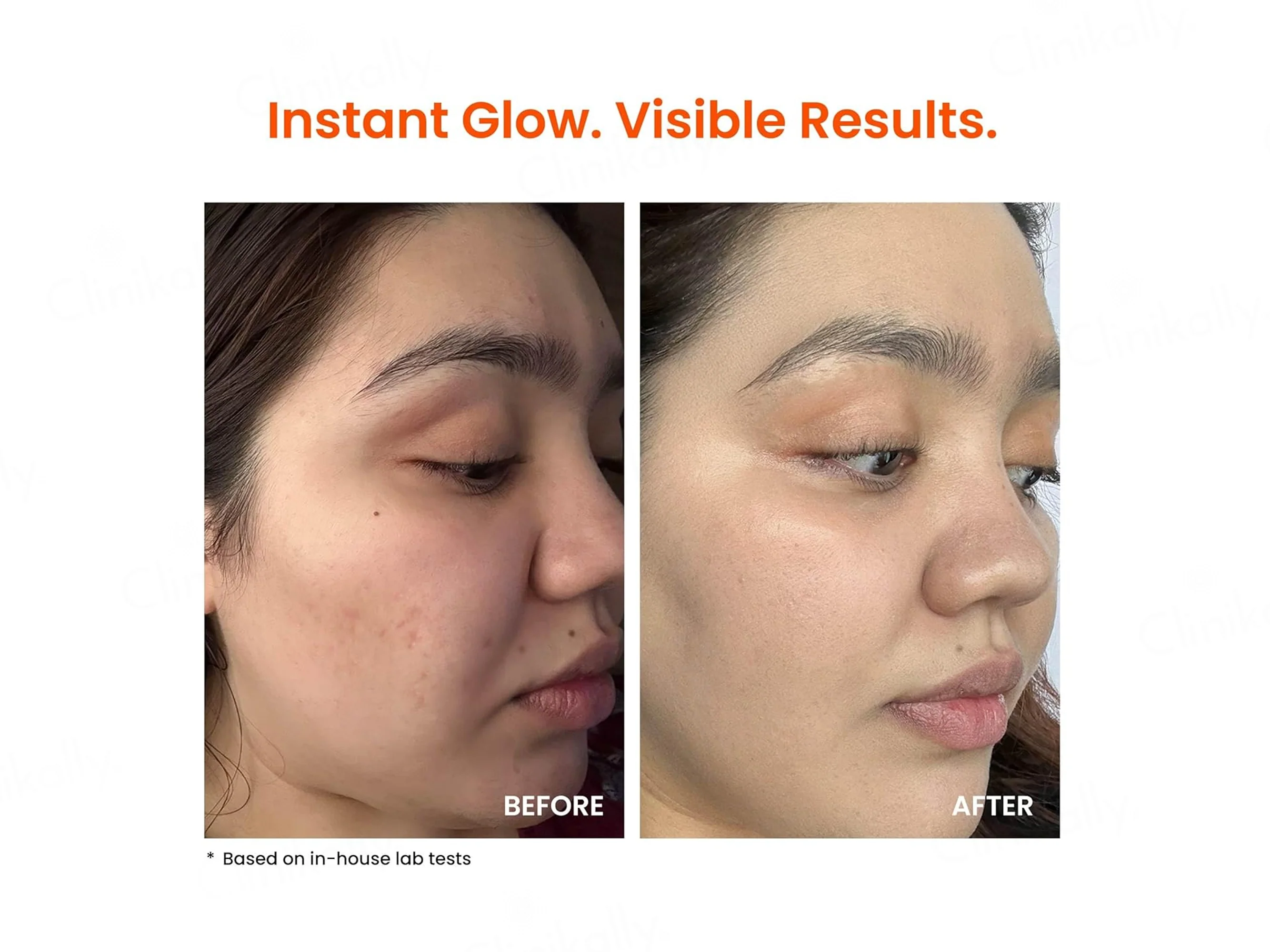Foxtale Super Glow Moisturizer - Image 6