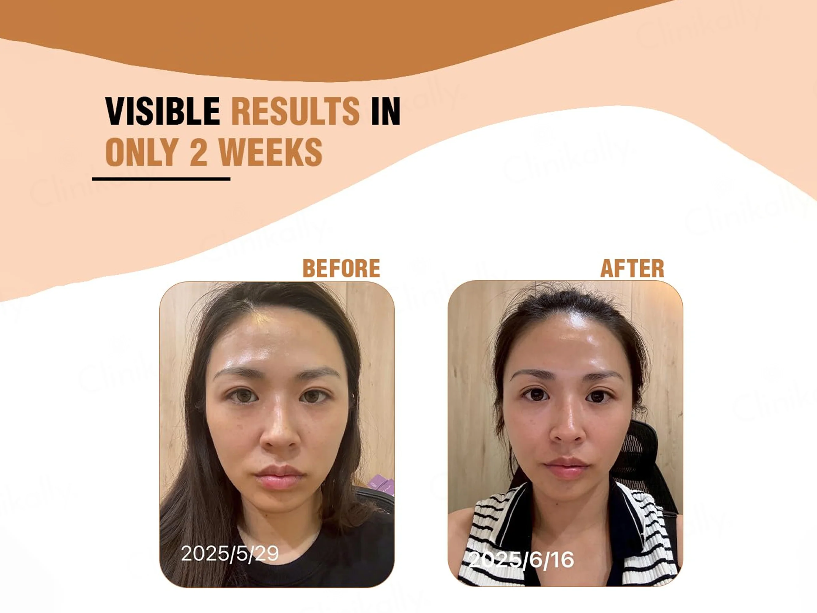 iMeMyself Well Aging Dietary Supplement Vegetarian Capsule - Image 7