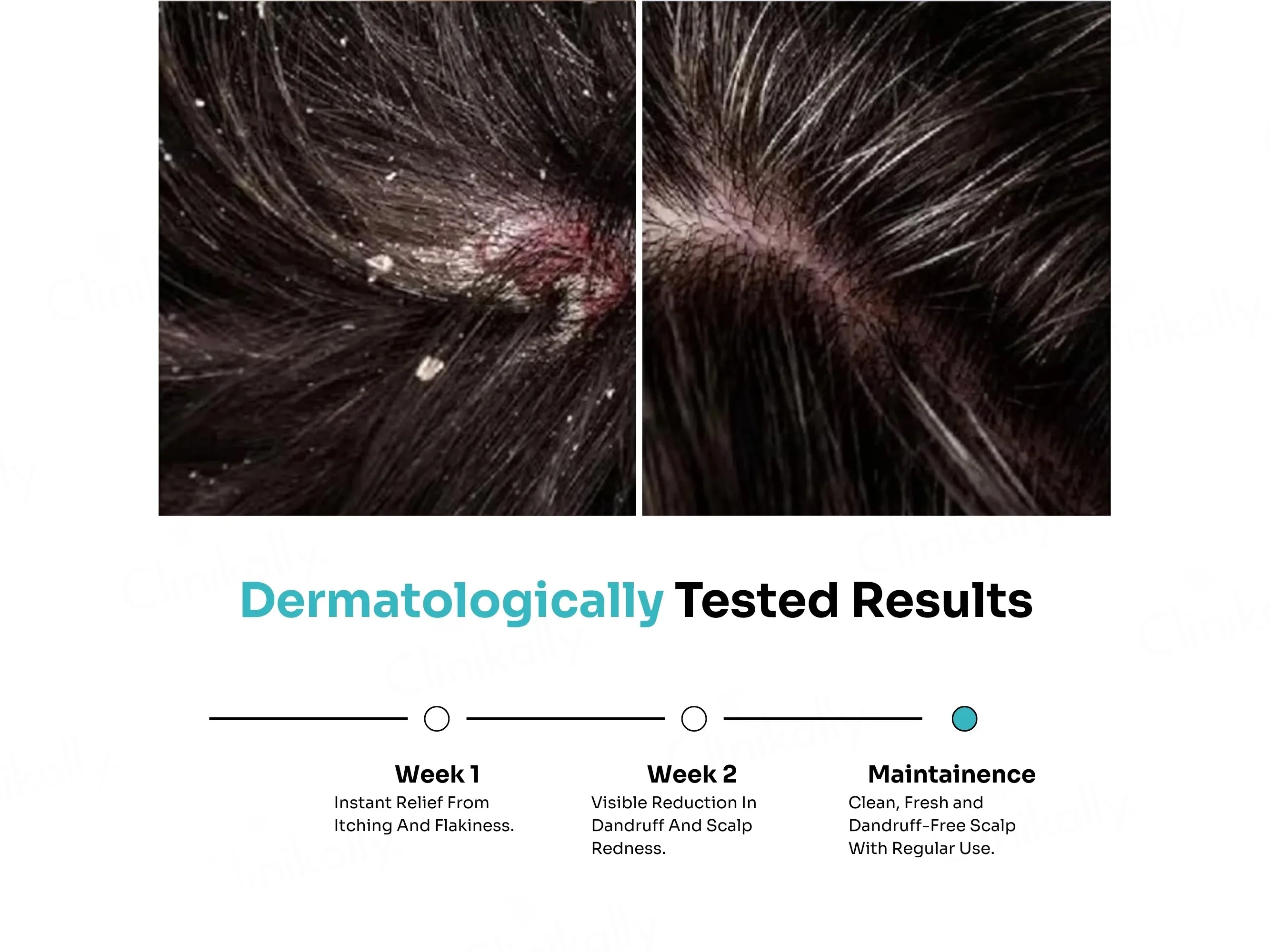 Kitcoz Anti-Dandruff & Anti-Itch Daily Use Shampoo - Image 2