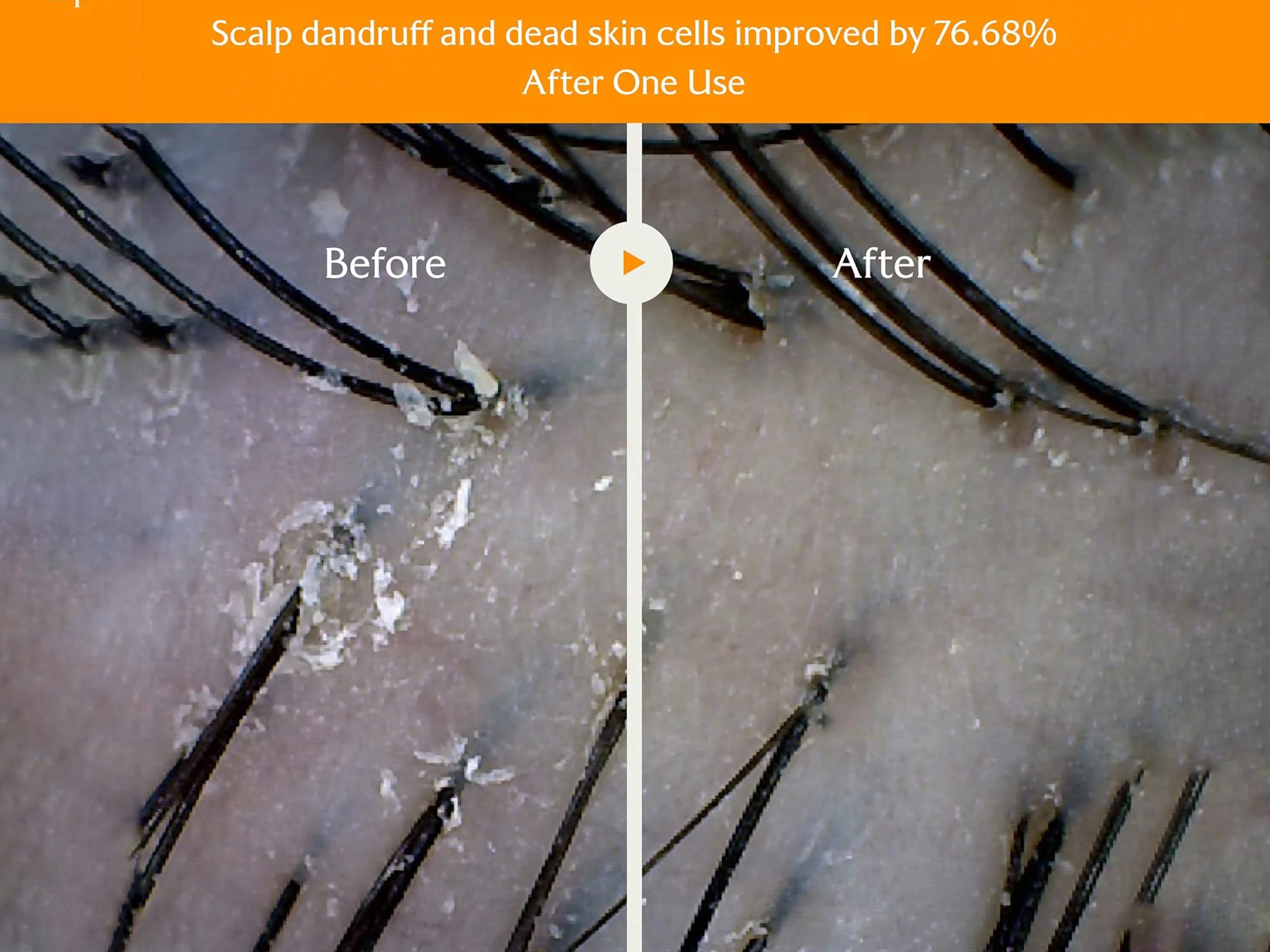 Lador ACV Vinegar Shampoo - Image 5