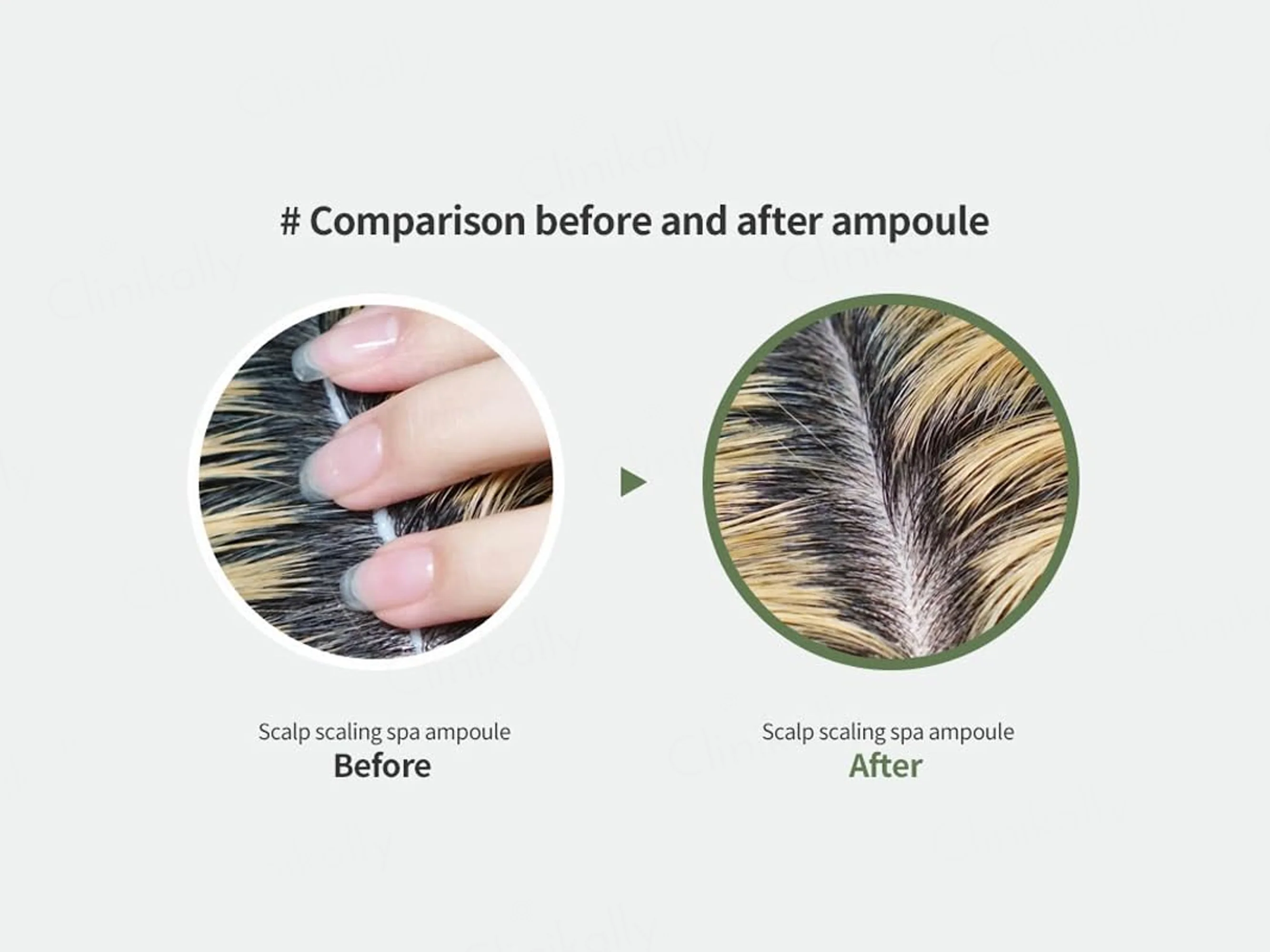 Lador Scalp Scaling Spa Ampoule - Image 9