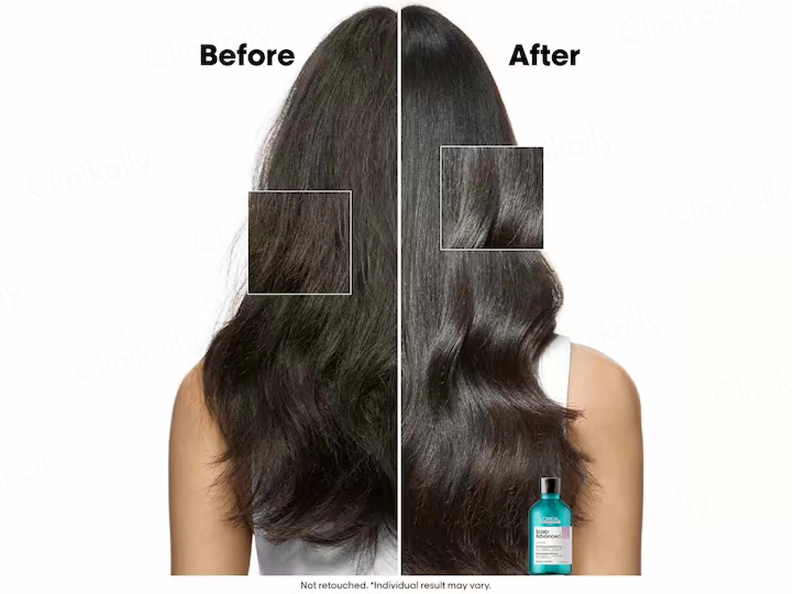 L'Oréal Professionnel Scalp Advanced Anti-Discomfort Dermo-Regulator Shampoo - Image 6