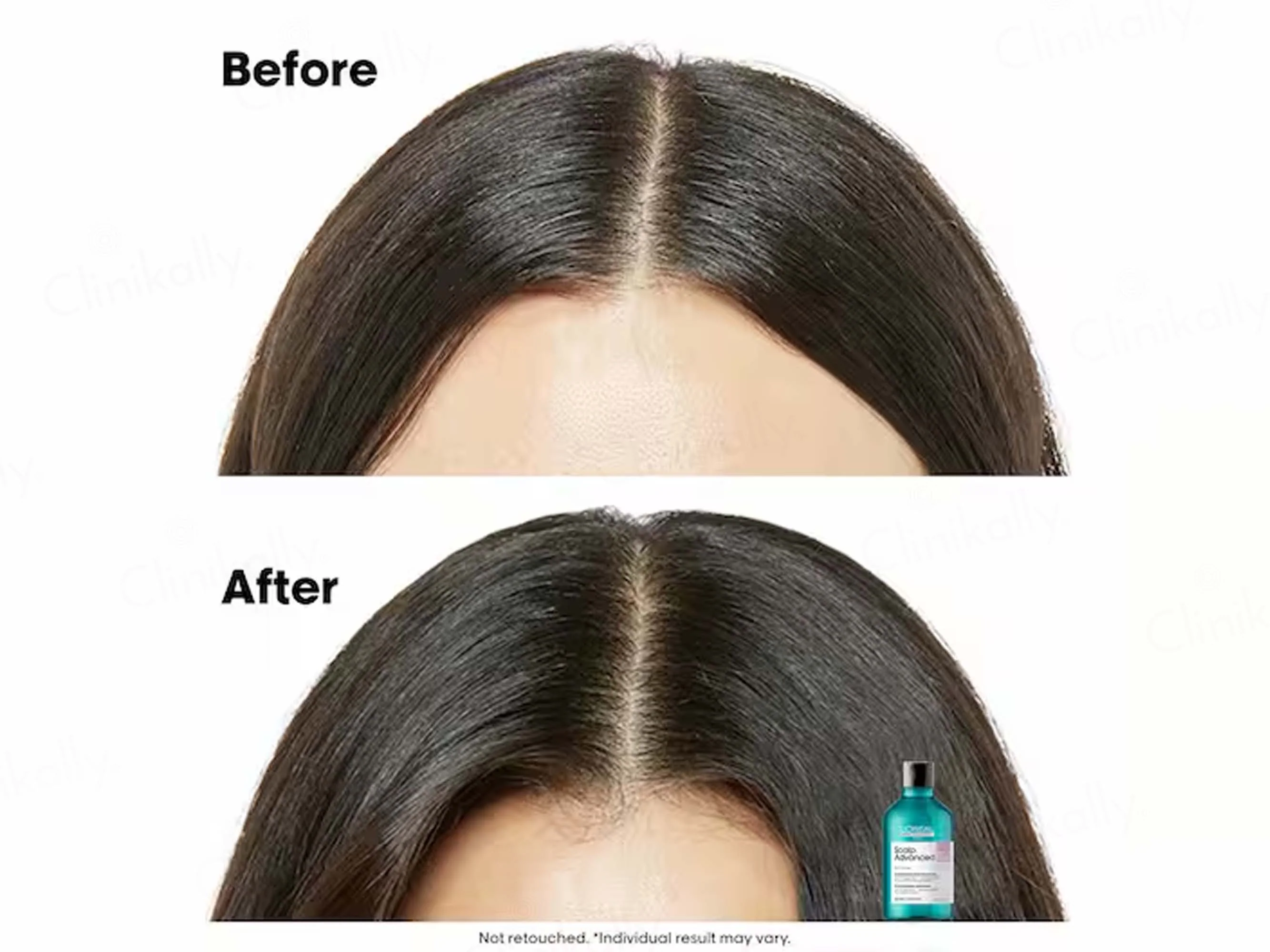 L'Oréal Professionnel Scalp Advanced Anti-Discomfort Dermo-Regulator Shampoo - Image 7