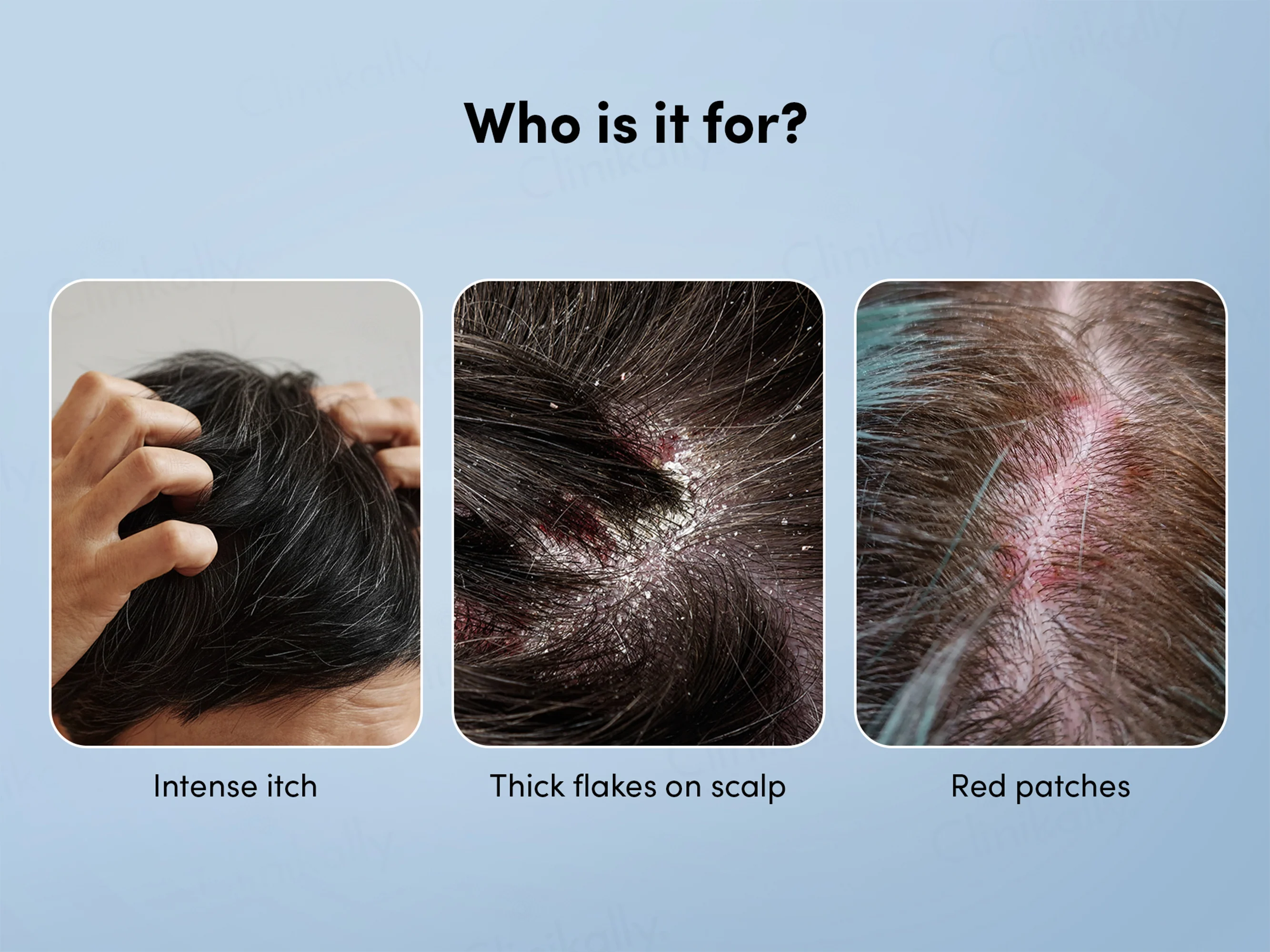 Man Matters Anti-Dandruff Shampoo - Image 3