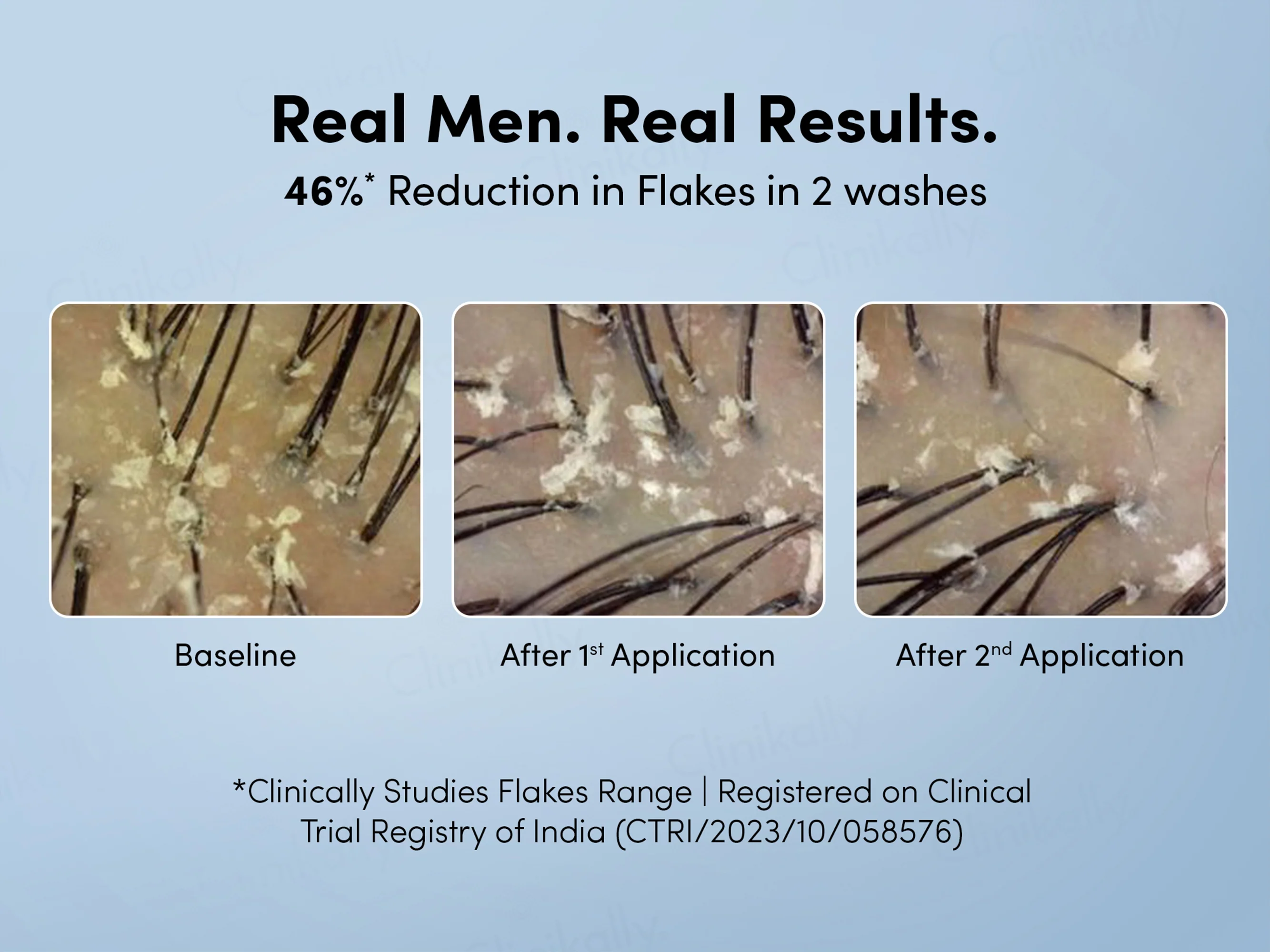 Man Matters Anti-Dandruff Shampoo - Image 8