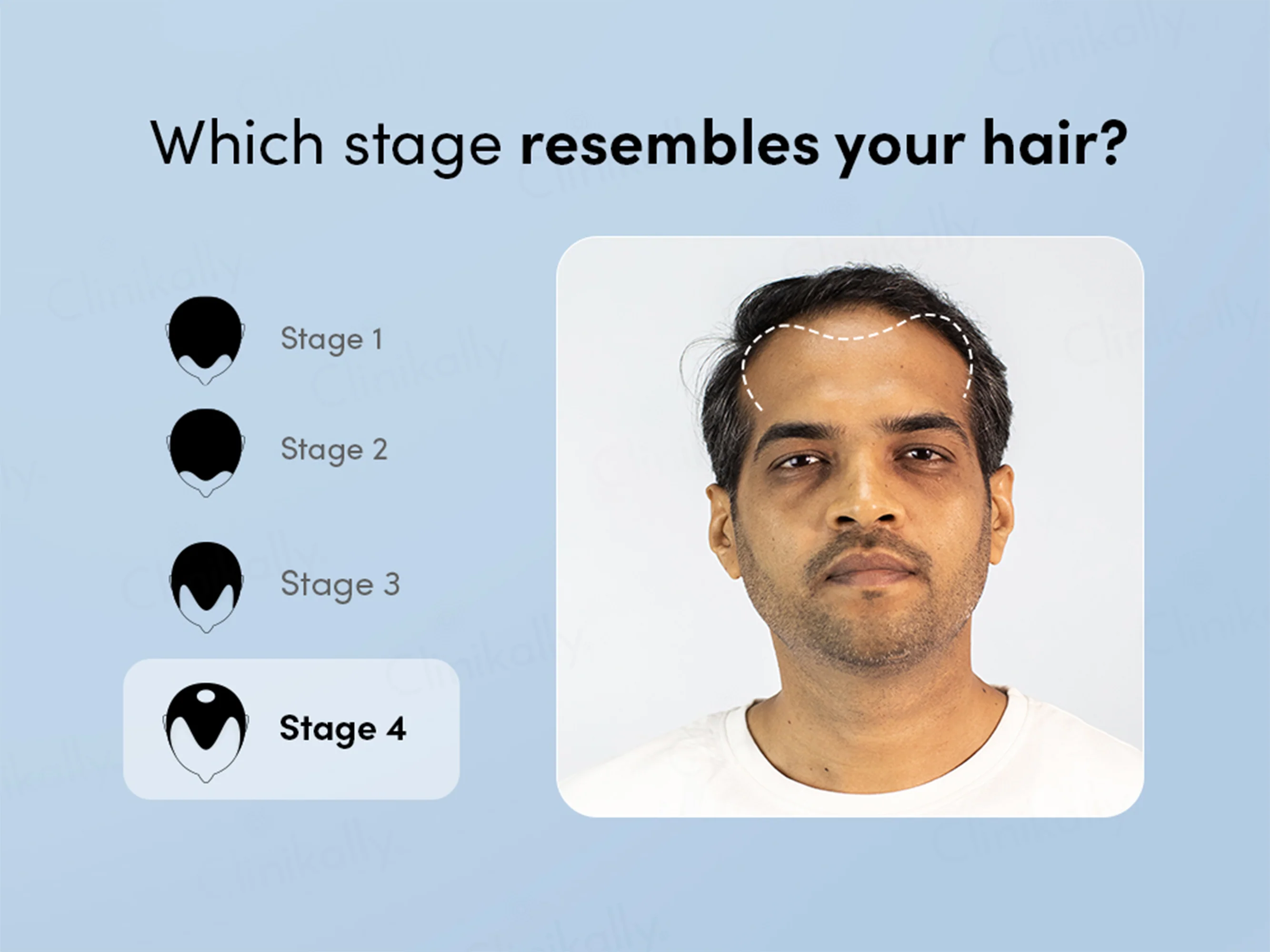 Man Matters Growmax+ Hair Topical Solution - Image 3