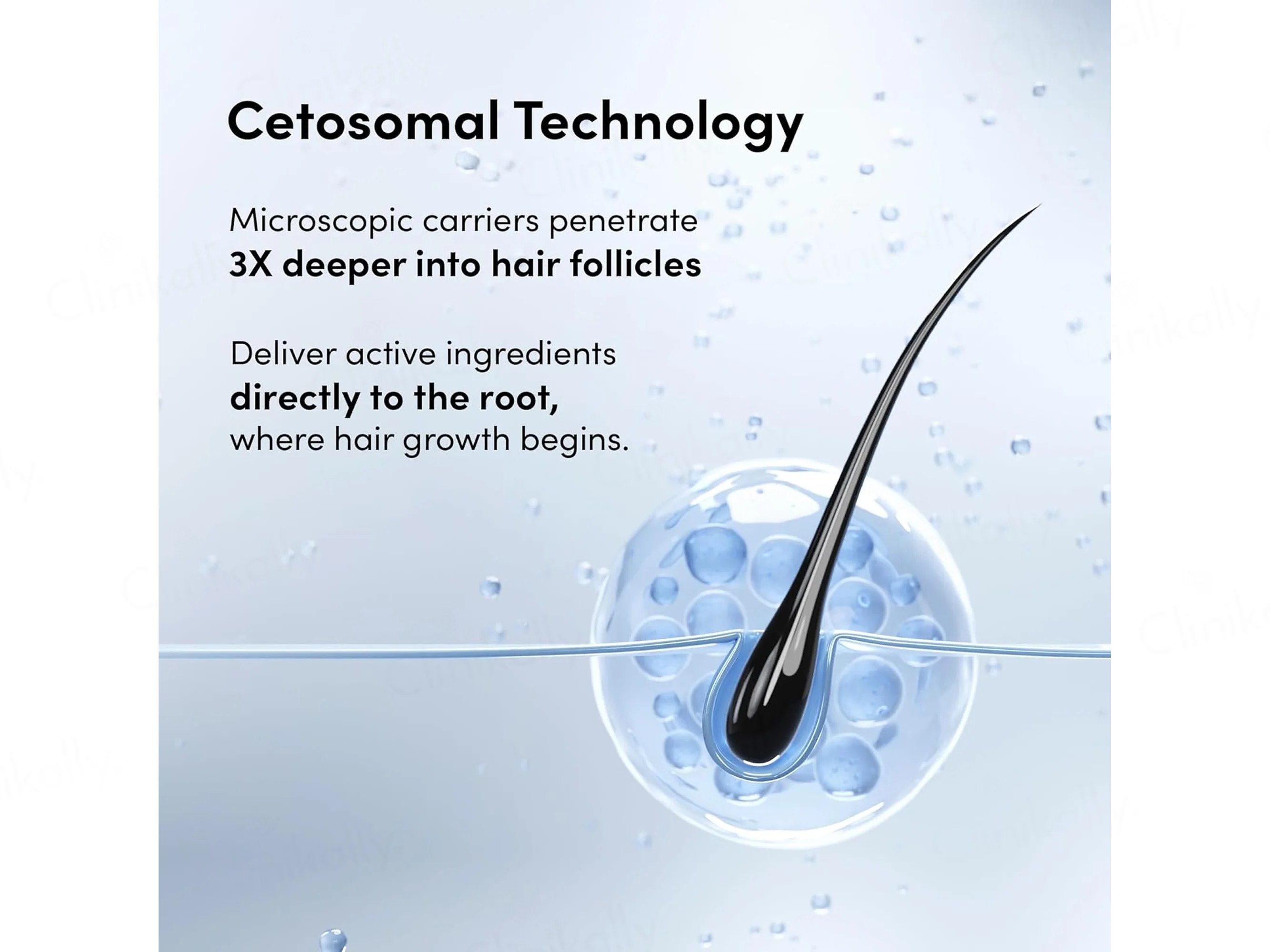 Man Matters Minoxifin Advance Hair Topical Solution - Image 6