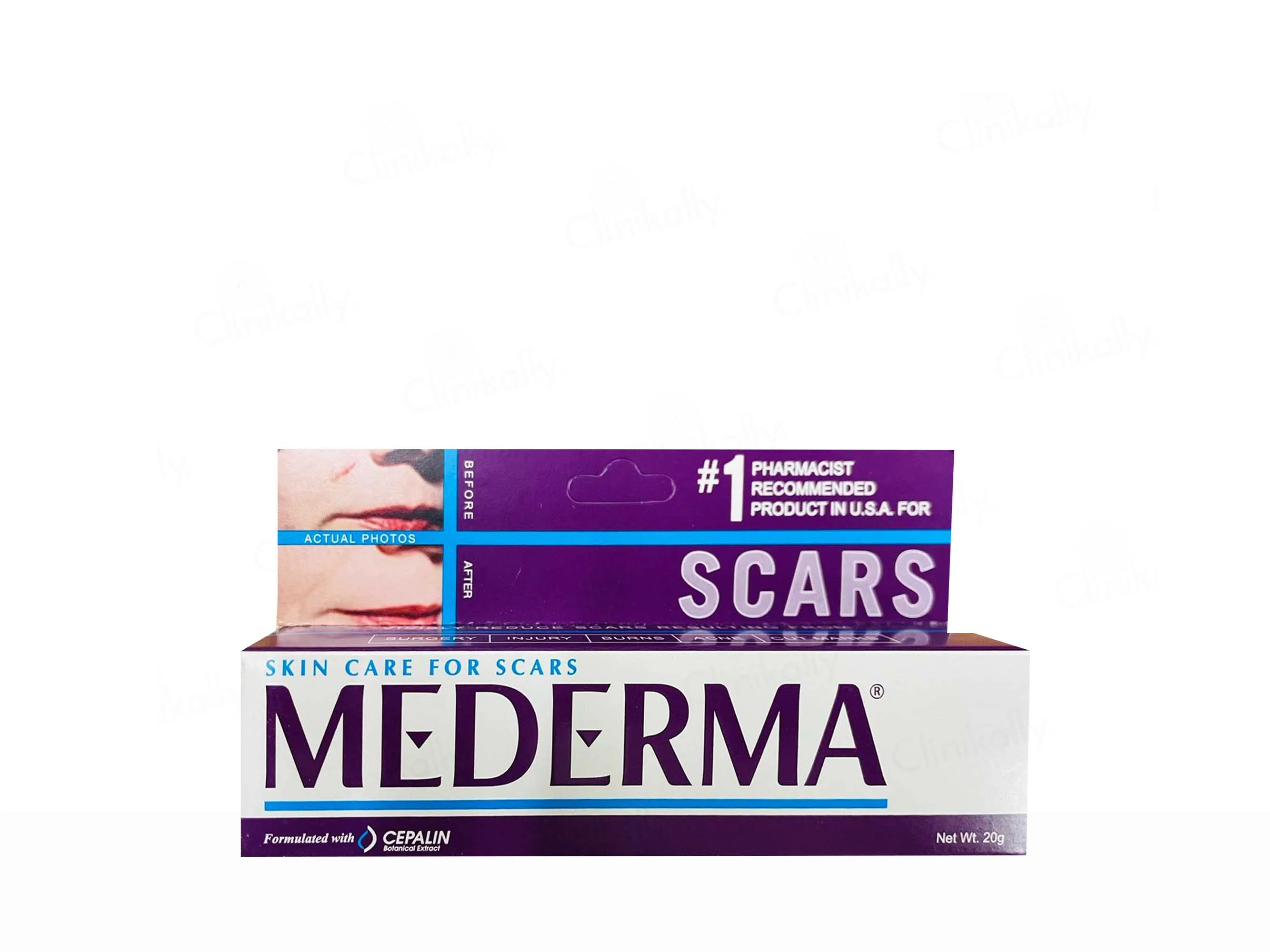 Mederma Skincare Scar Gel - Image 2