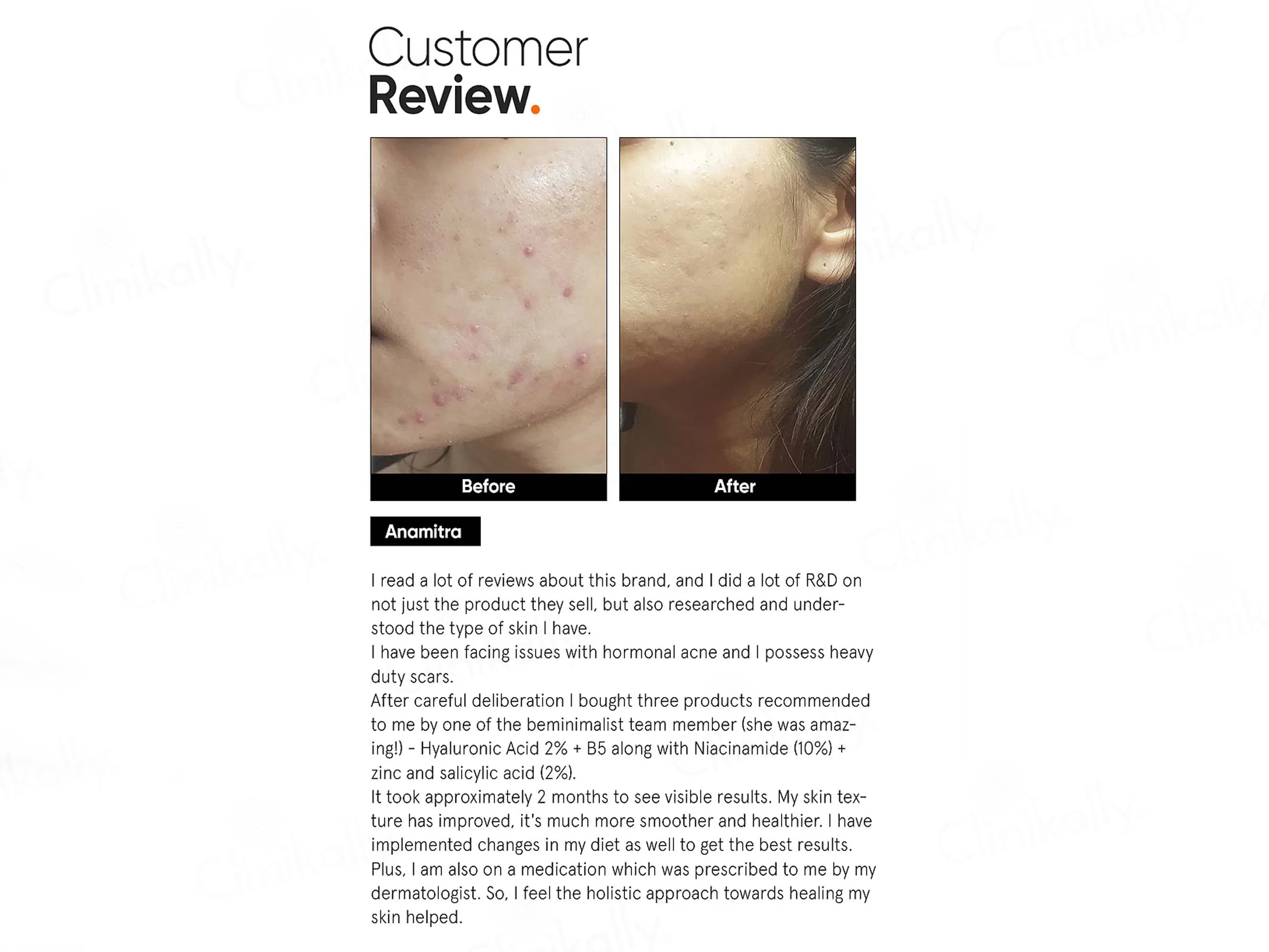 Minimalist 2% Hyaluronic Acid + PGA Face Serum - Image 7