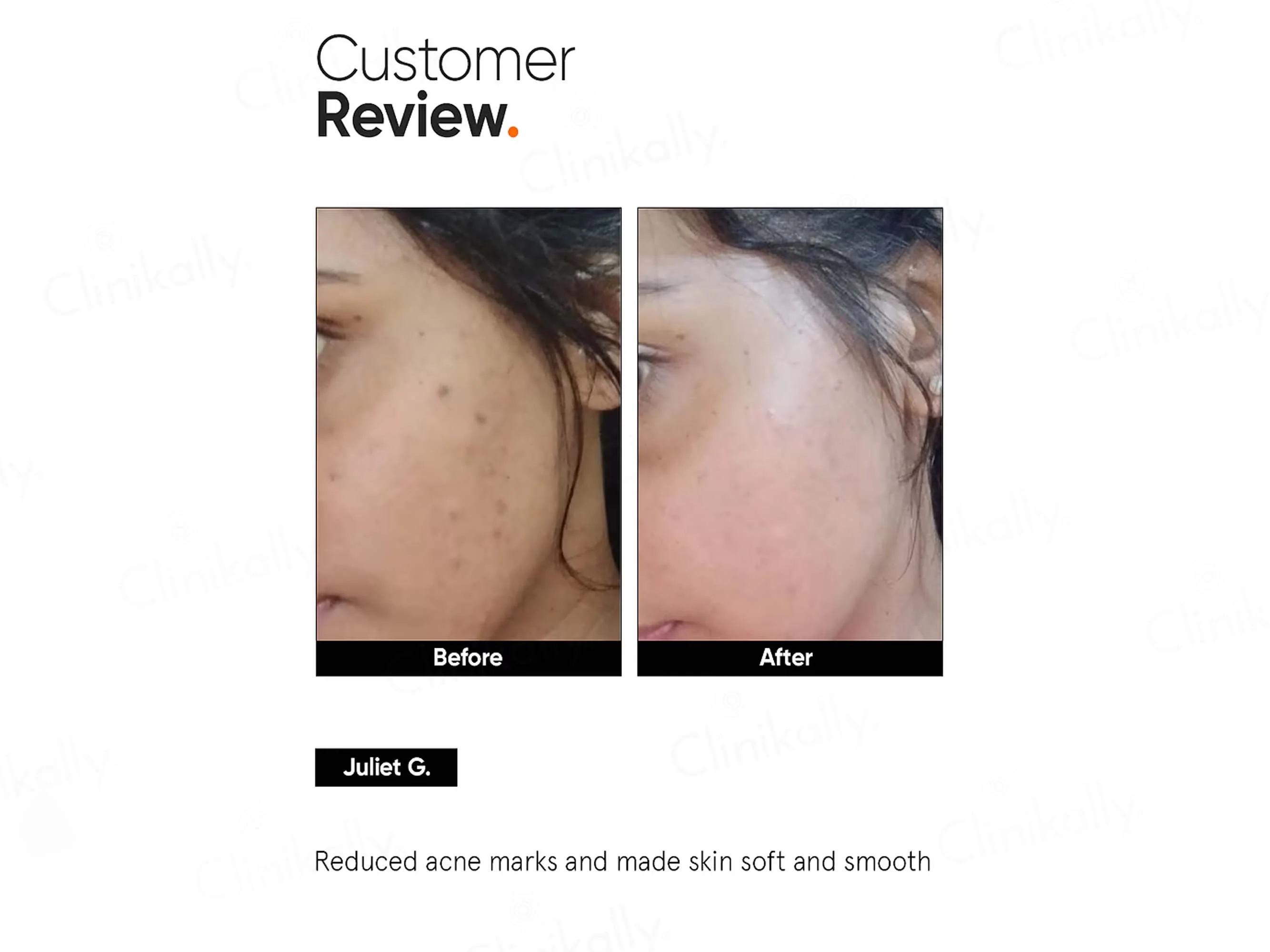 Minimalist 5% Niacinamide Face Serum - Image 7