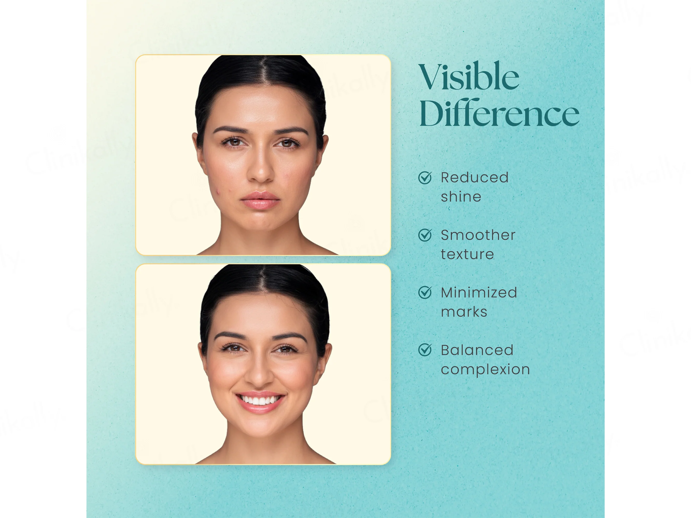Moha: Face Moisturizer For Oily Skin - Image 7