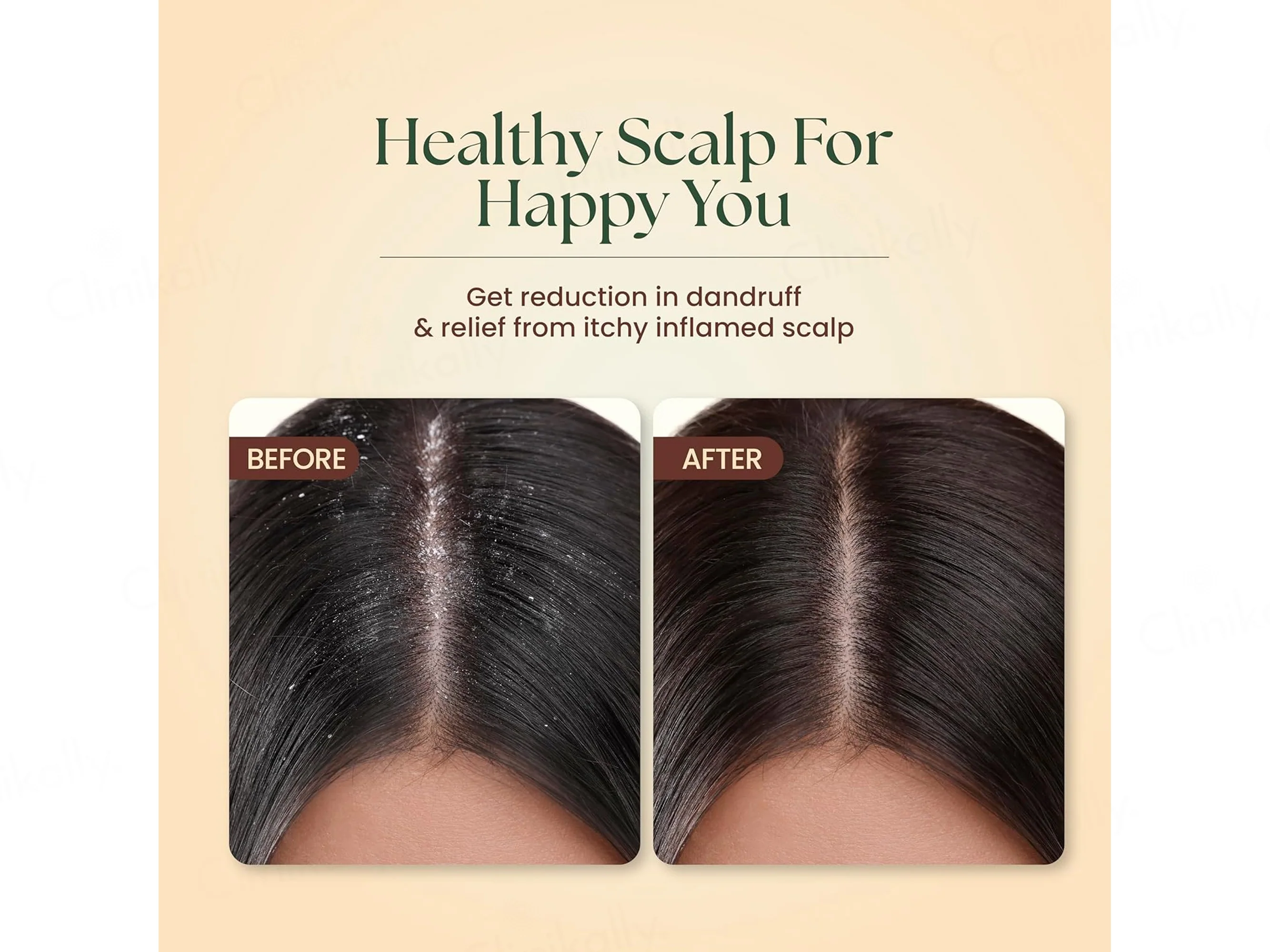 Moha: Neem & Hibiscus Anti-Dandruff Shampoo - Image 6