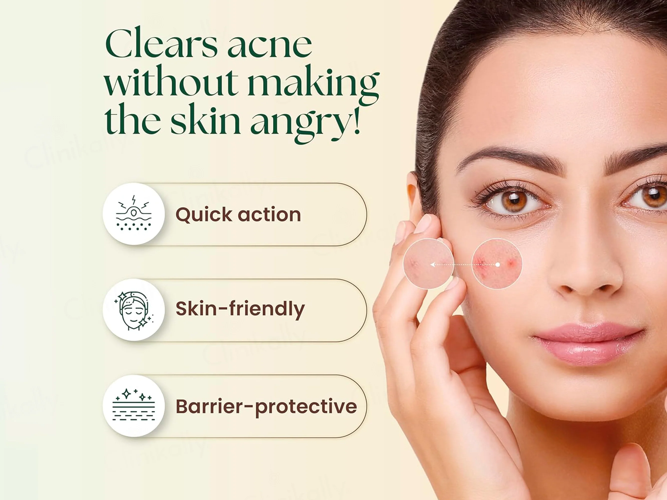 Moha: Spot Corrector Anti Acne Gel - Image 3