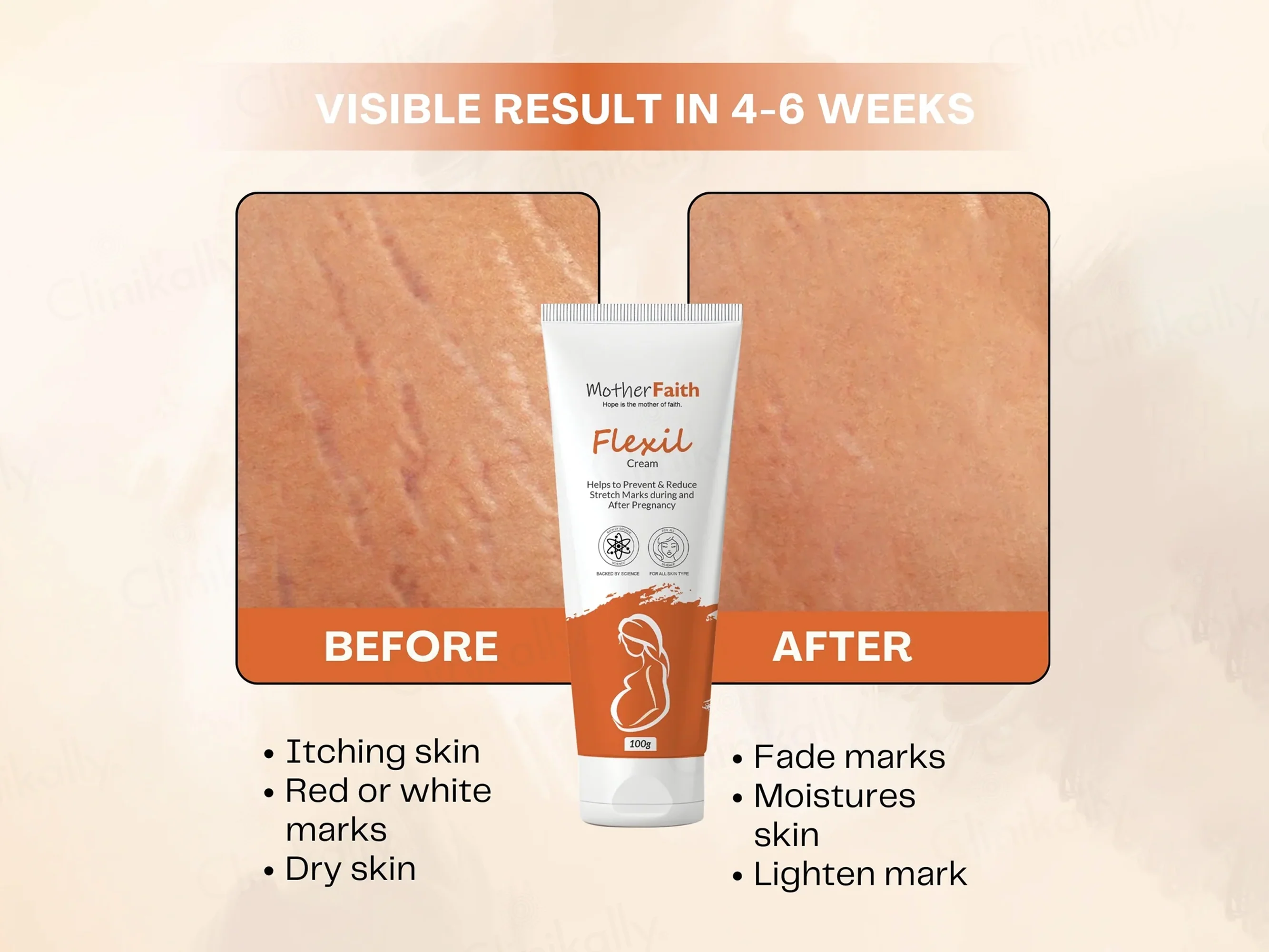 Motherfaith Flexil Stretch Marks Cream - Image 6