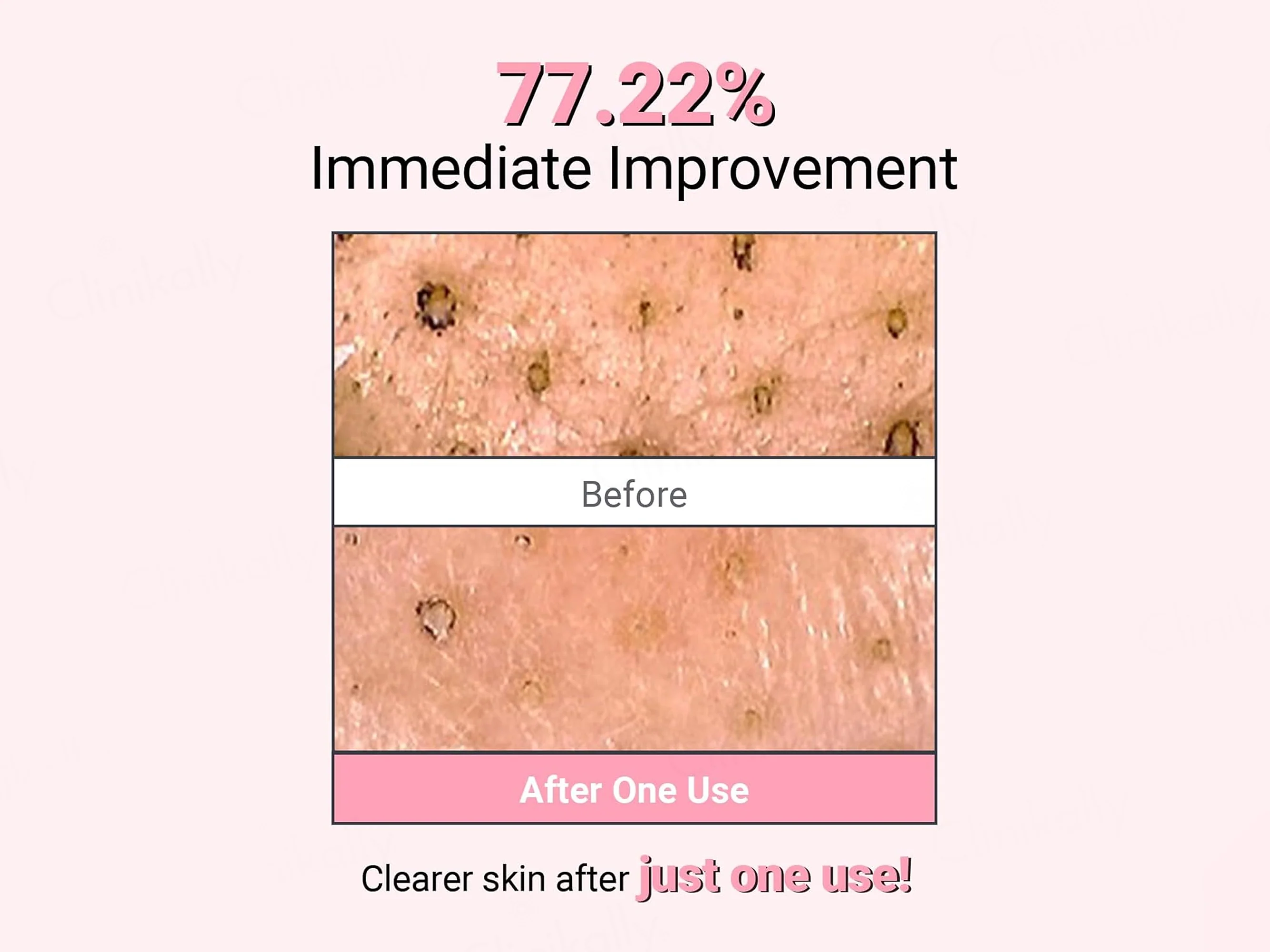 Neaf Neaf Kaolin Purifying Wash Off Mask - Image 3