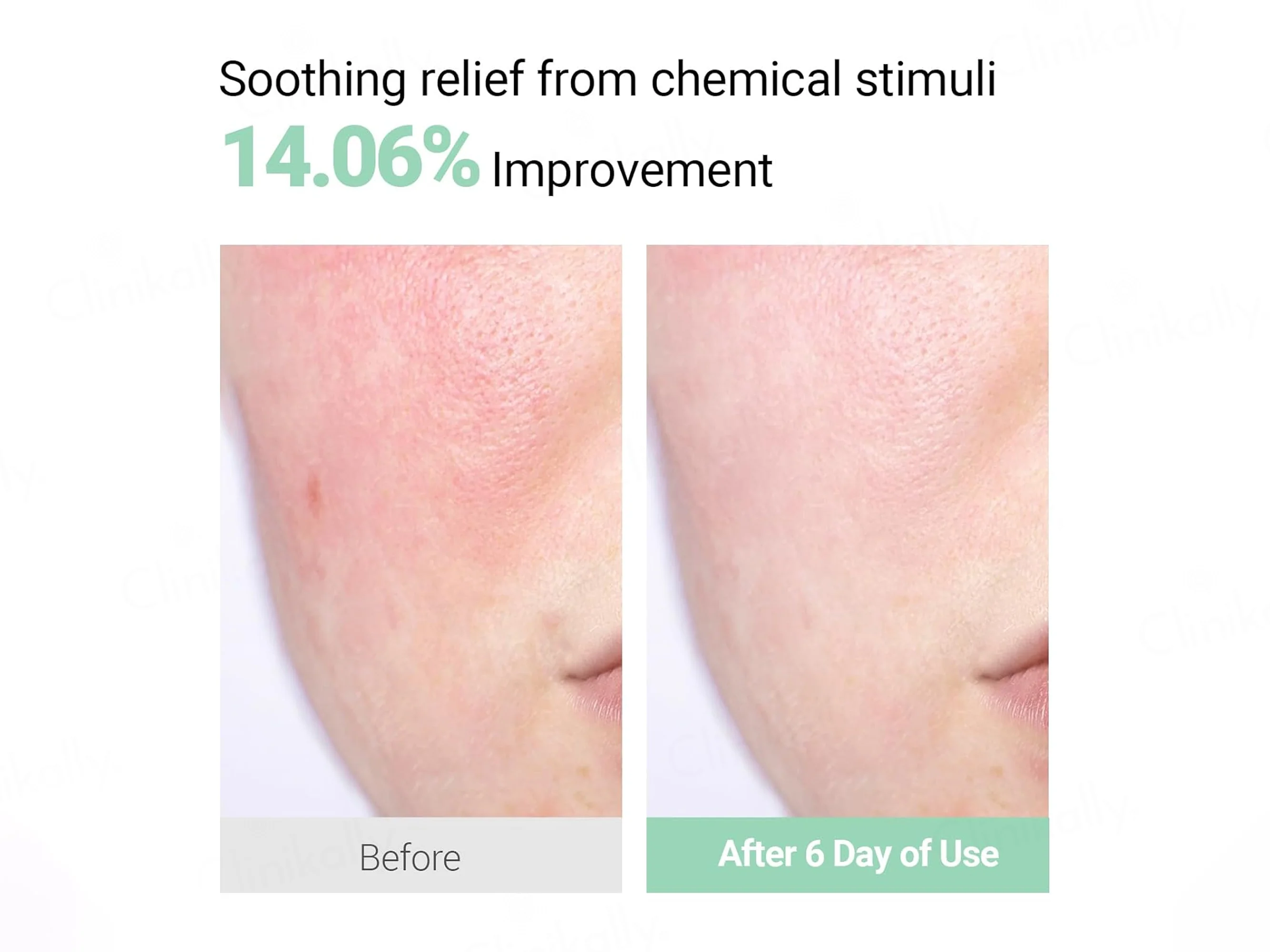 Neaf Neaf Smoothing Calm Cream - Image 4