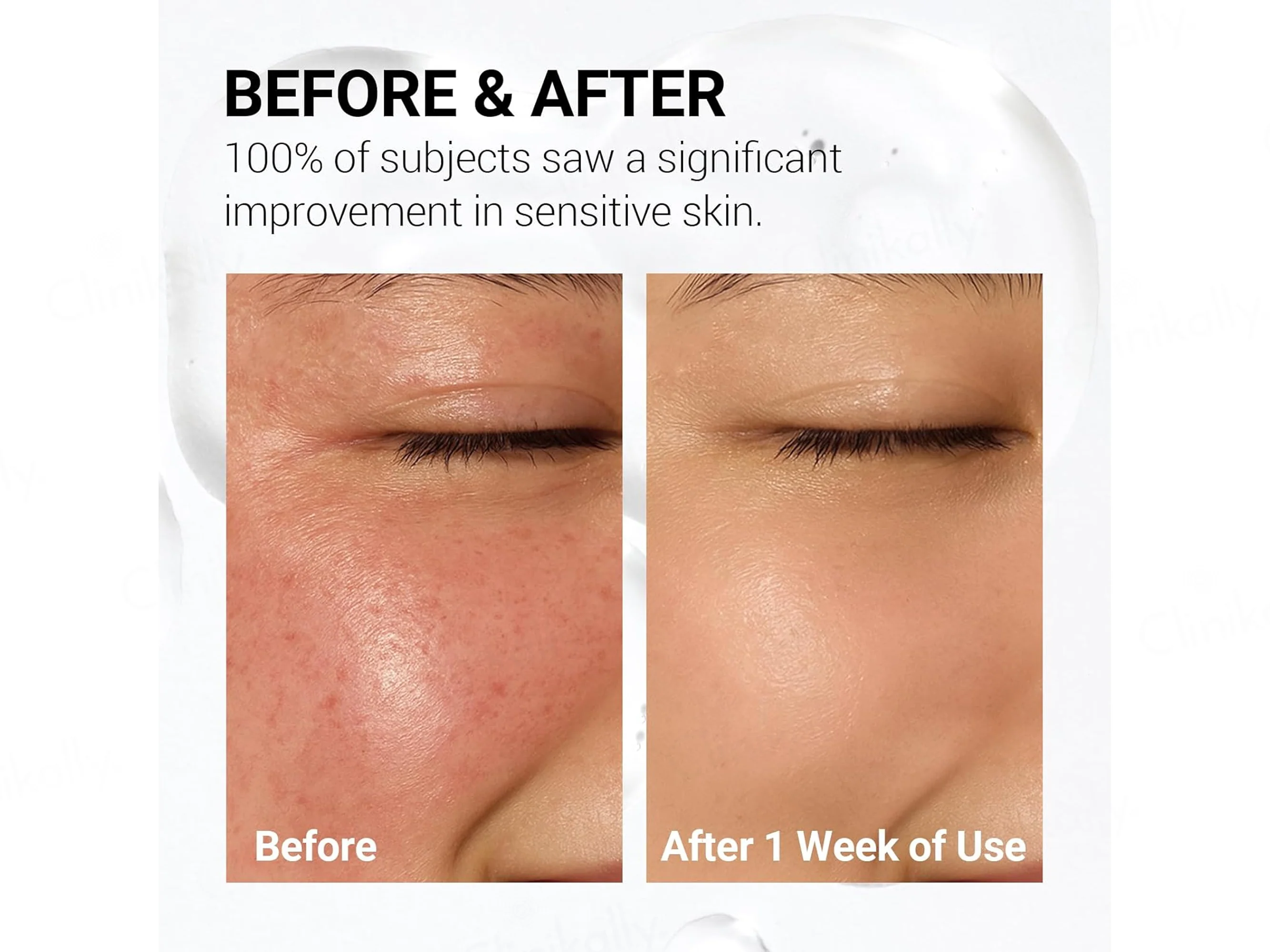 Neaf Neaf Soothing Calm Toner Pads - Image 4