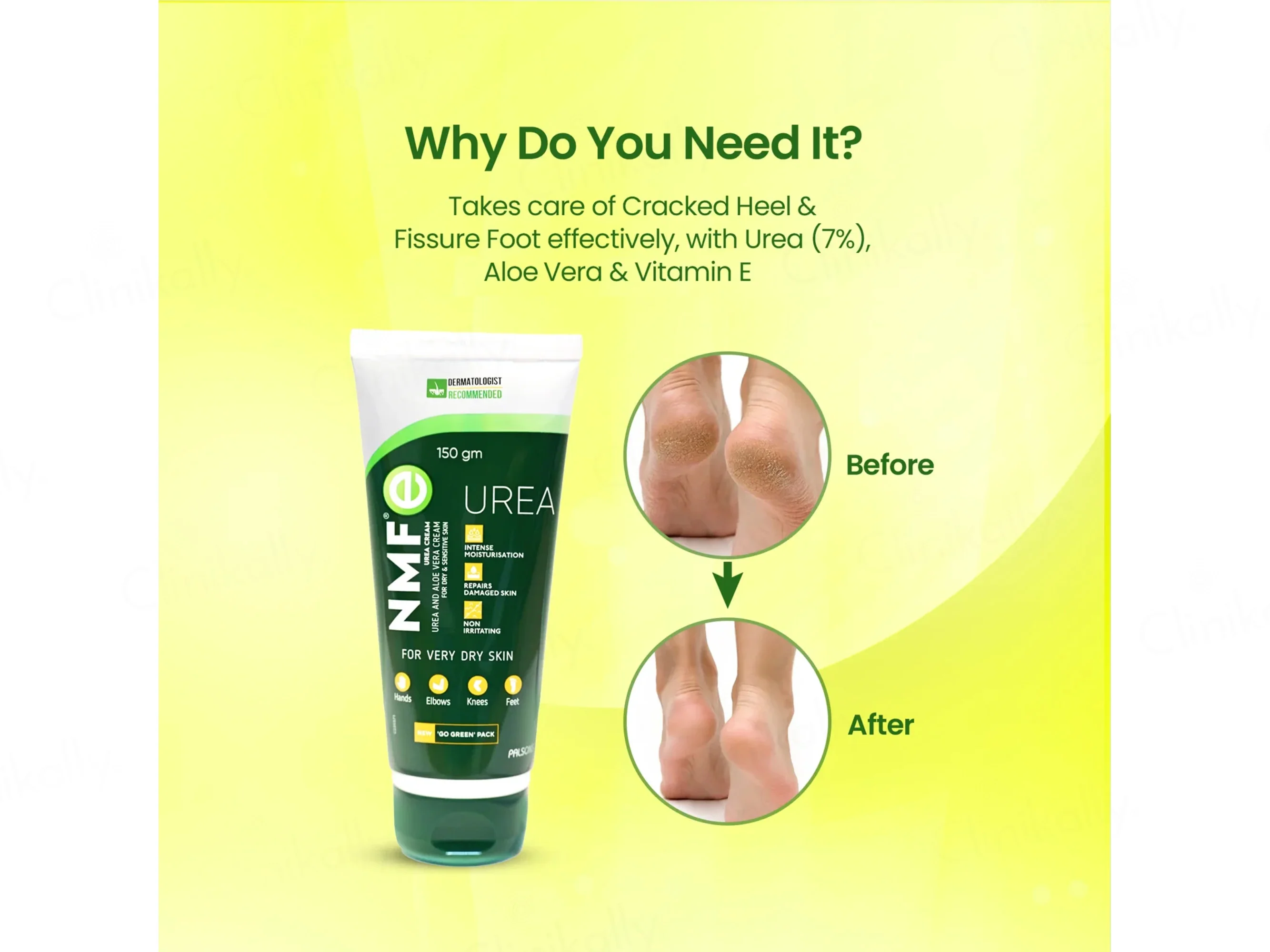 NMFe Urea and Aloe Vera Cream For Very Dry Skin - Image 5