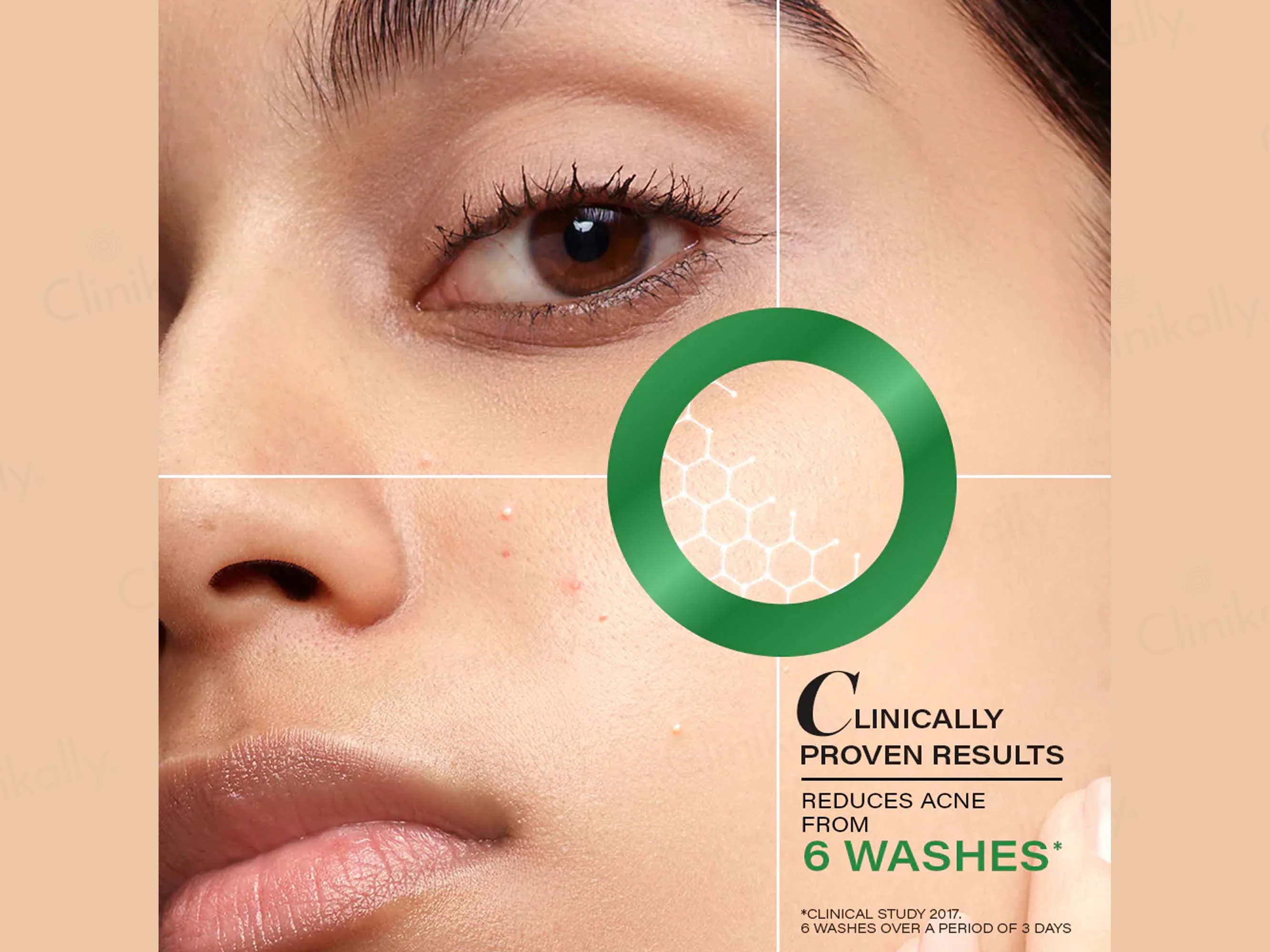 Novology Acne Deep Clearing Cleanser - Image 4