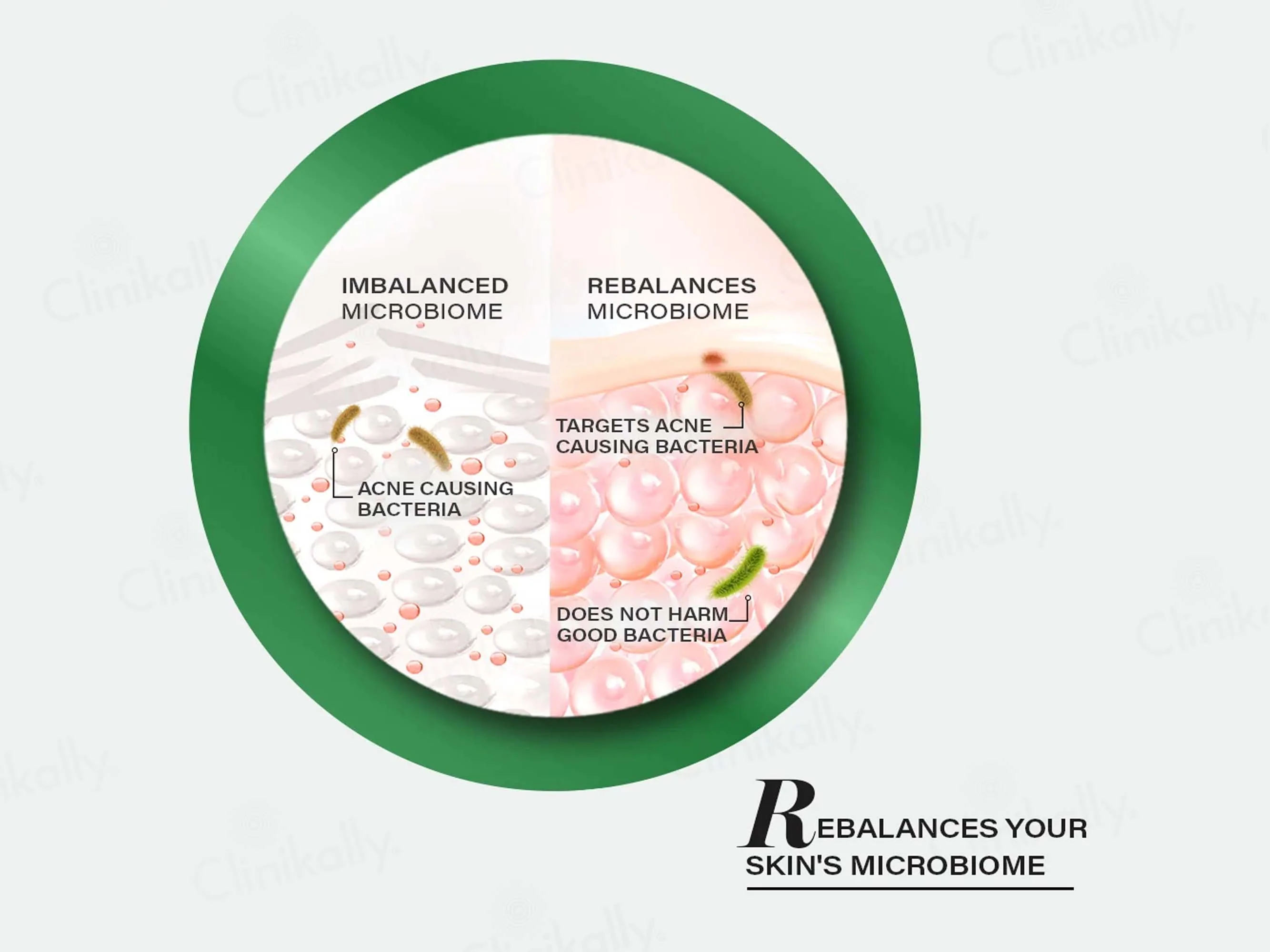 Novology Acne Deep Clearing Cleanser - Image 7
