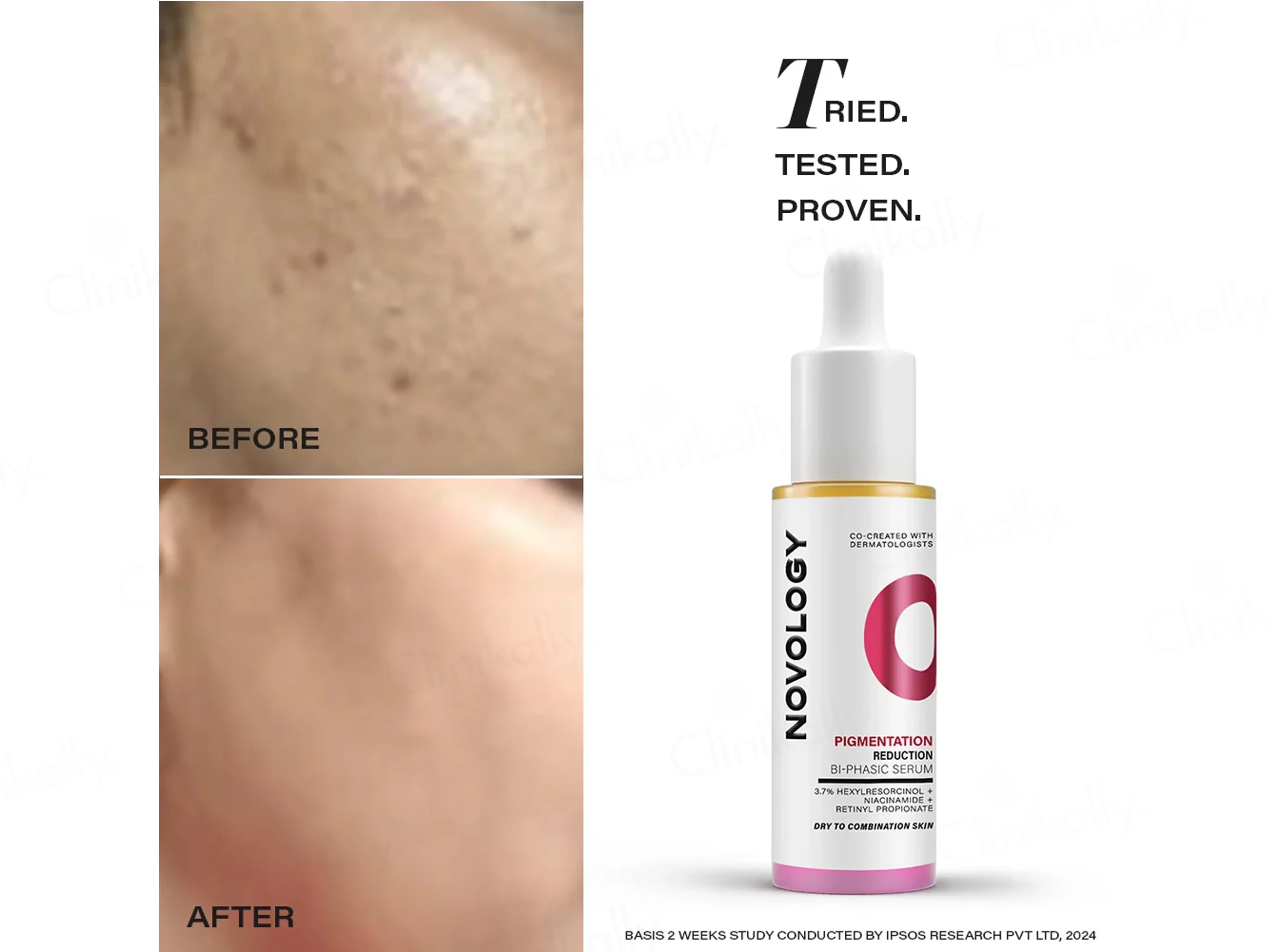 Novology Pigmentation Reduction Bi-Phasic Serum For Dry To Combination Skin - Image 9