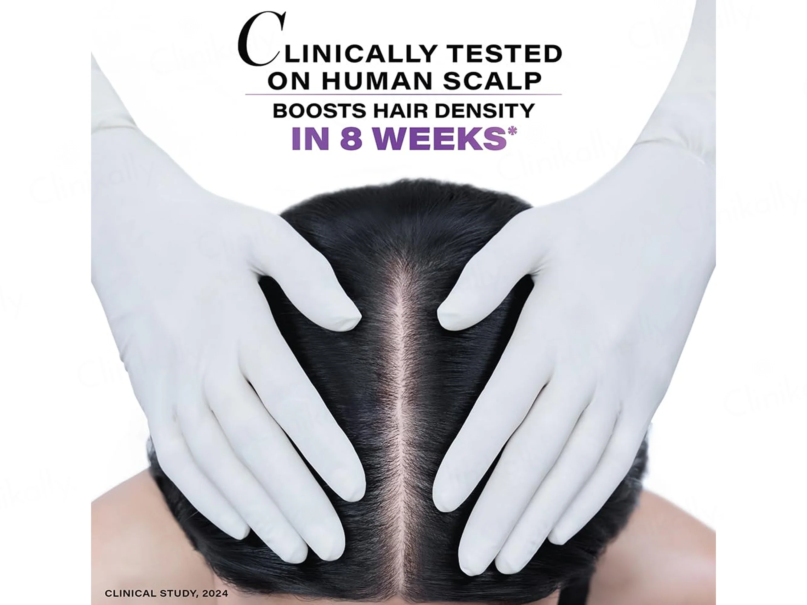 Novology Follicle Revive Hair Growth Scalp Serum - Image 5