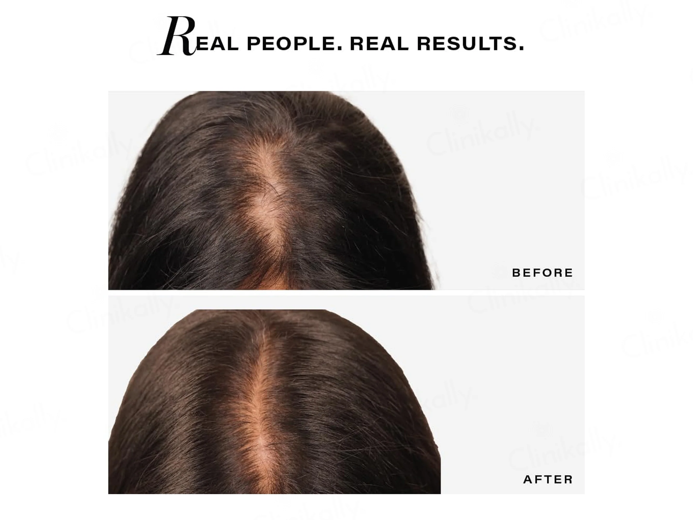 Novology Follicle Revive Hair Growth Scalp Serum - Image 8