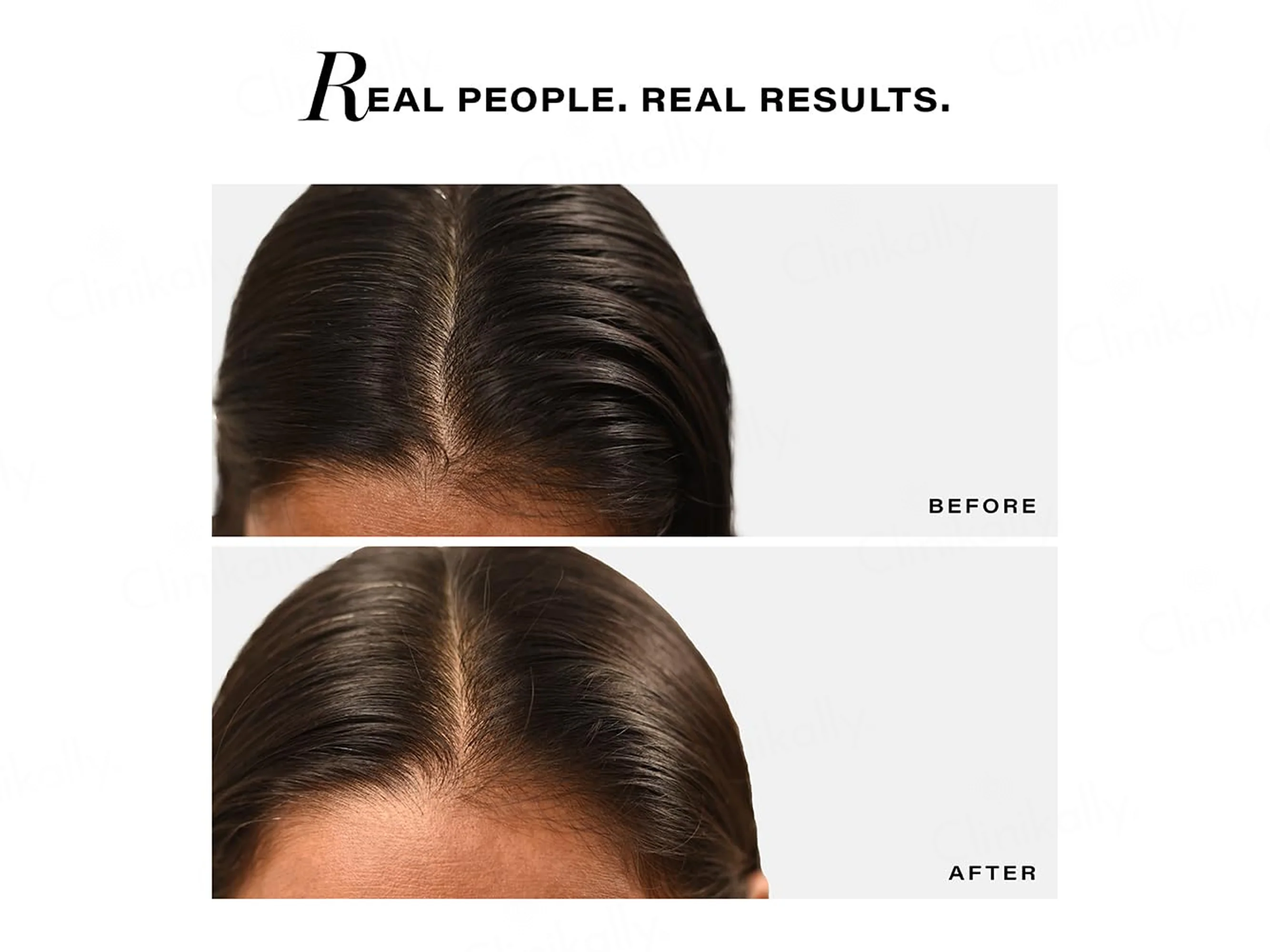 Novology Sebosys Control Scalp Serum For Oily Scalp - Image 5