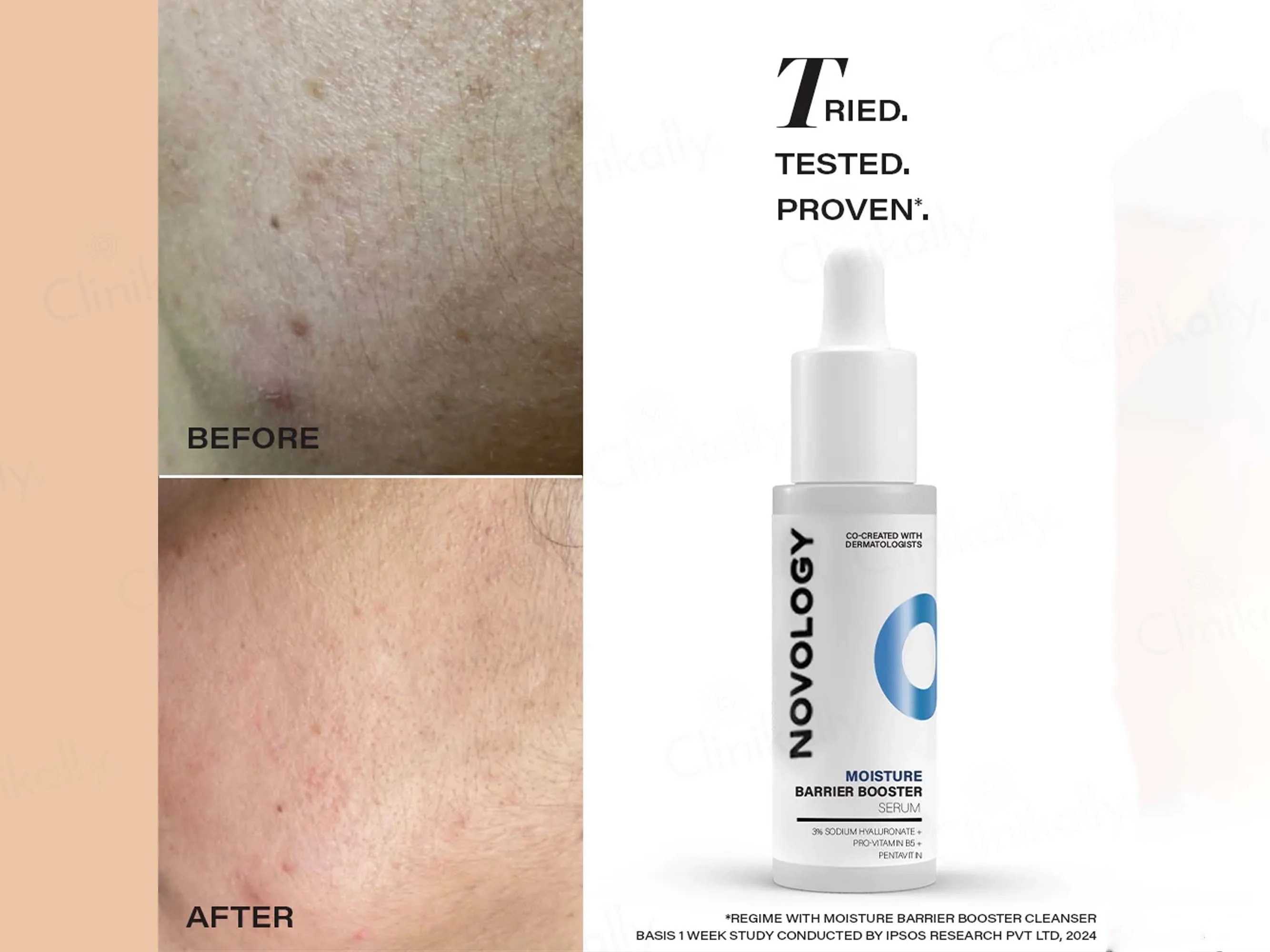 Novology Moisture Barrier Booster Serum - Image 6