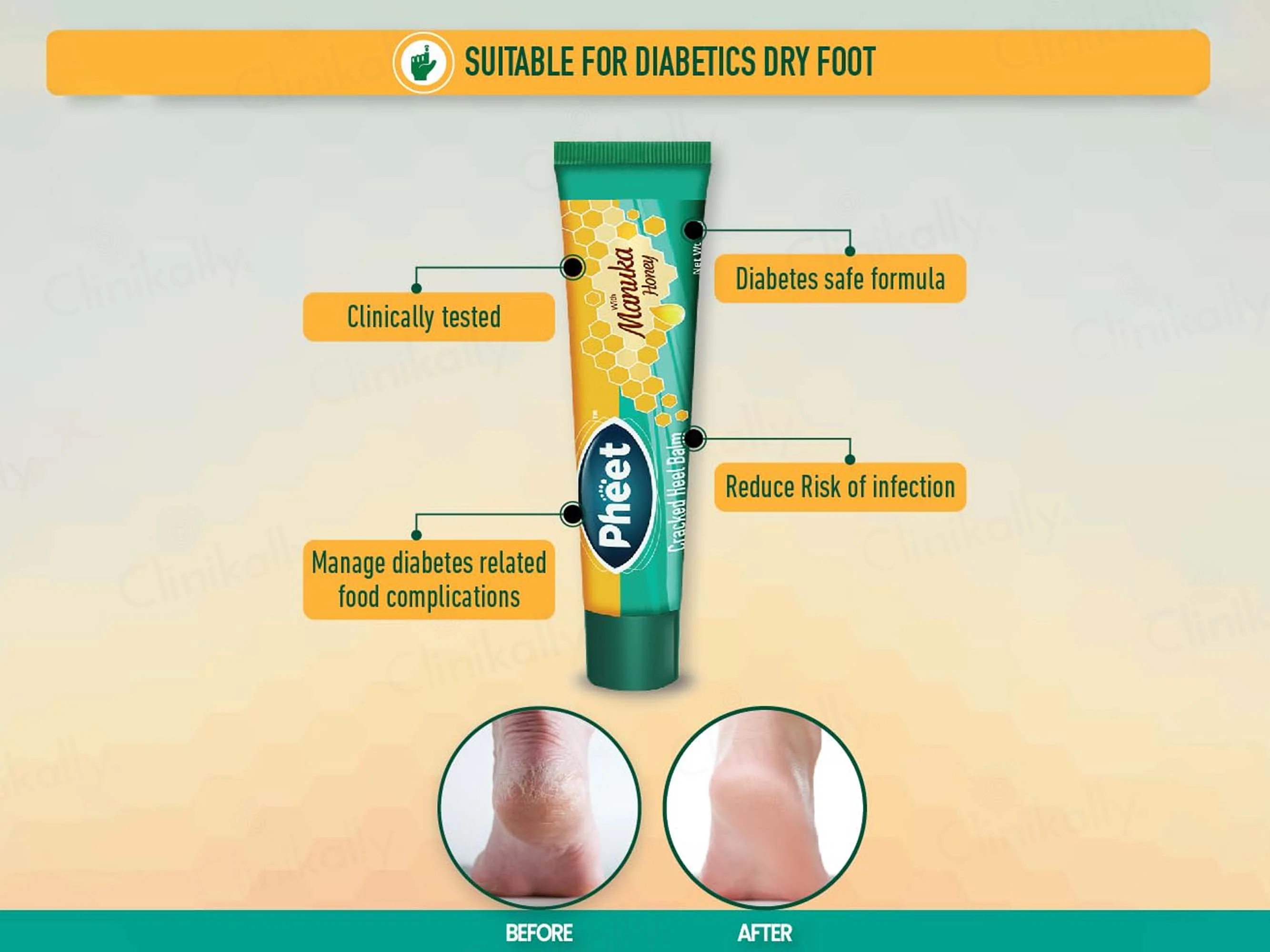 Pheet Cracked Heel Balm - Image 8