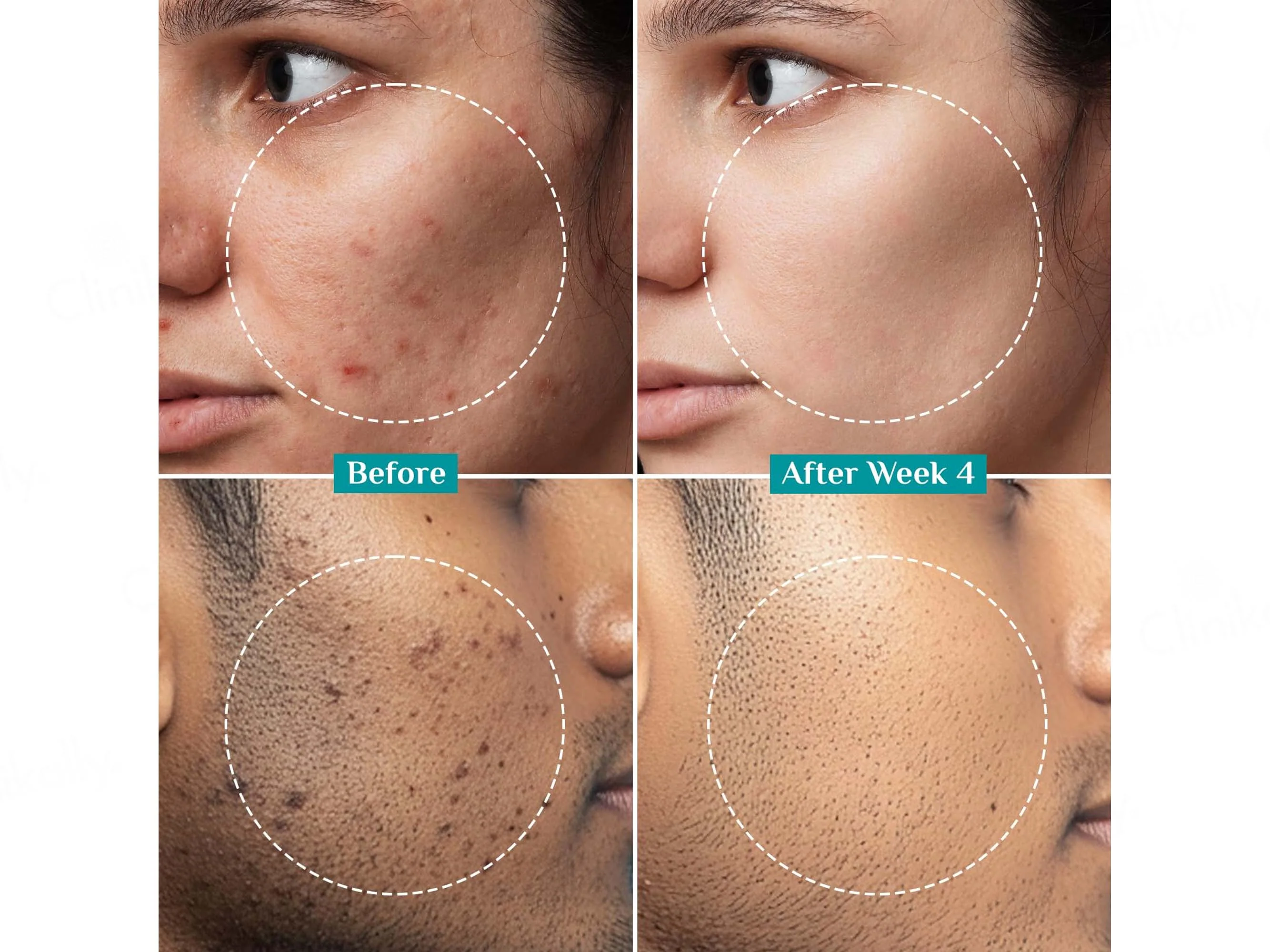 Pilgrim Alpha Arbutin & Vitamin C Brightening Serum - Image 5