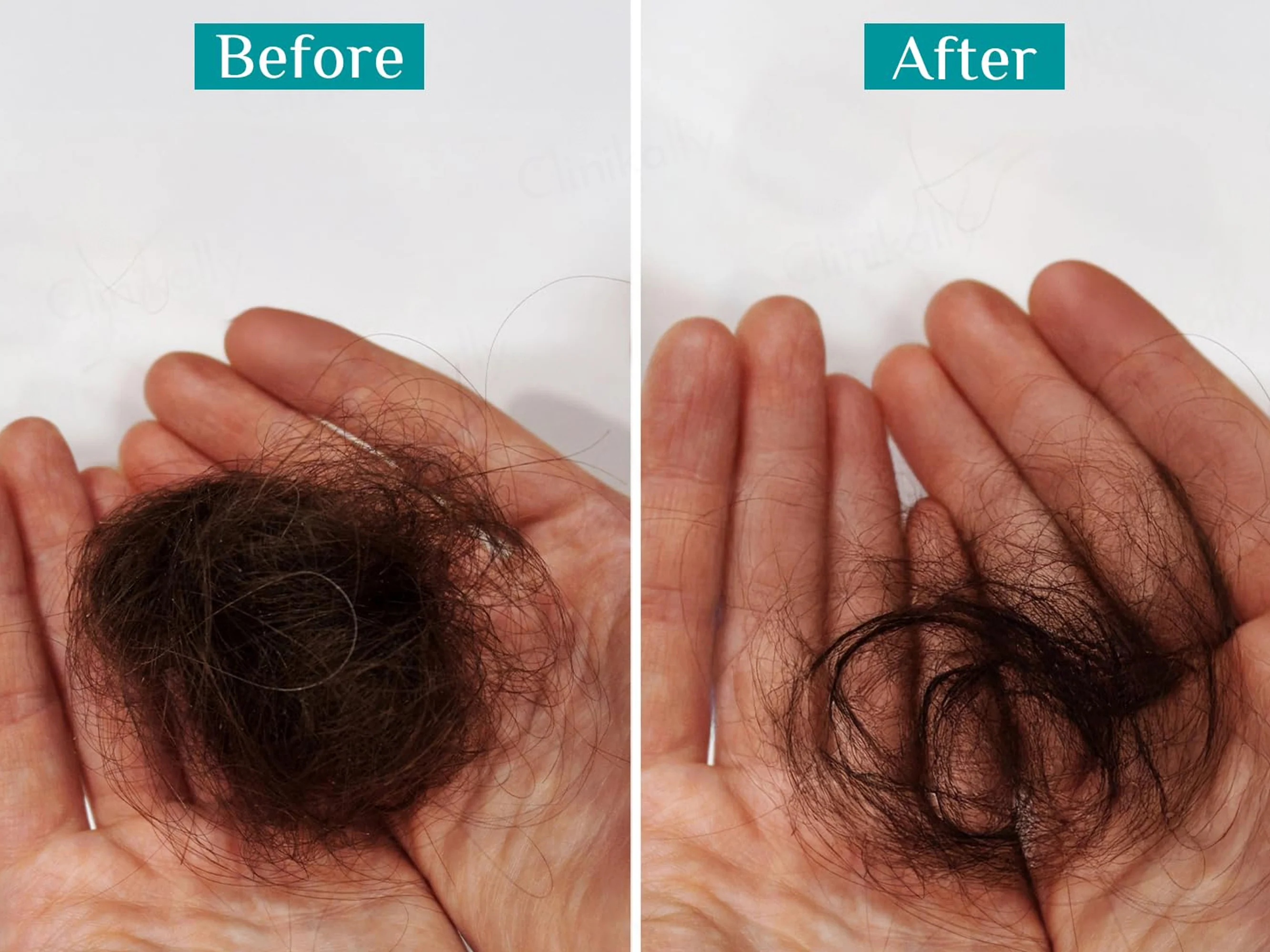 Pilgrim Redensyl & Anagain Hairfall Control Shampoo With Korean Black Rice - Image 3