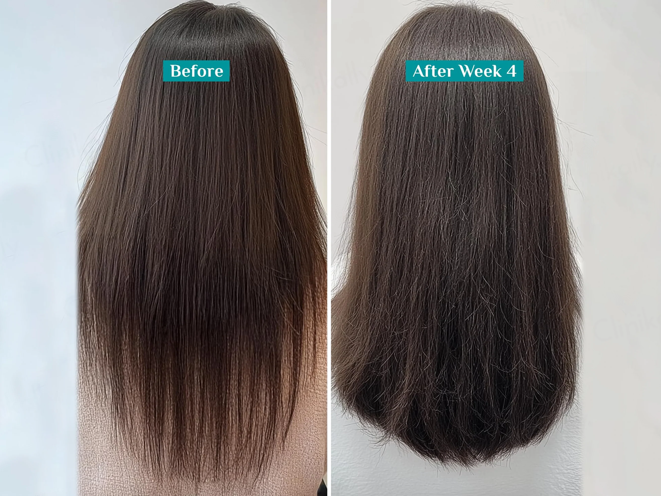 Pilgrim Redensyl & Anagain Hairfall Control Shampoo With Korean Black Rice - Image 4